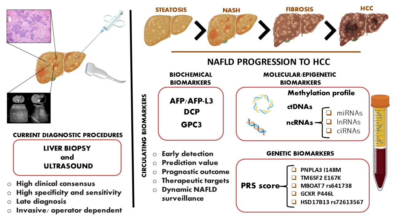Old-fashioned and newly discovered biomarkers: the future of NAFLD-related HCC screening and monitoring