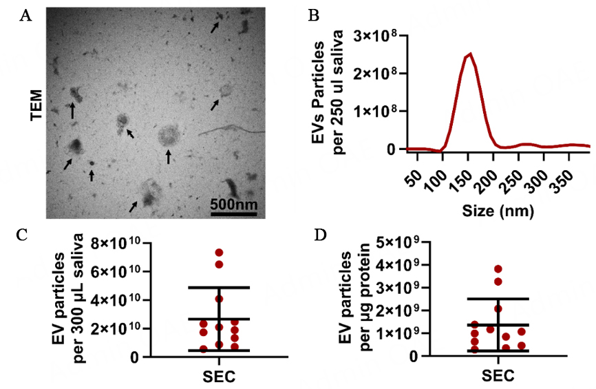 Immunoaffinity-enriched salivary small extracellular vesicles in periodontitis