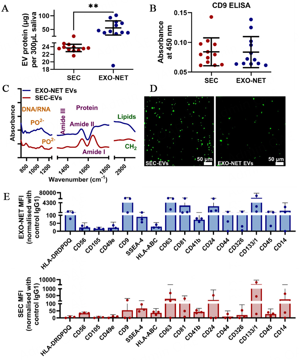Immunoaffinity-enriched salivary small extracellular vesicles in periodontitis