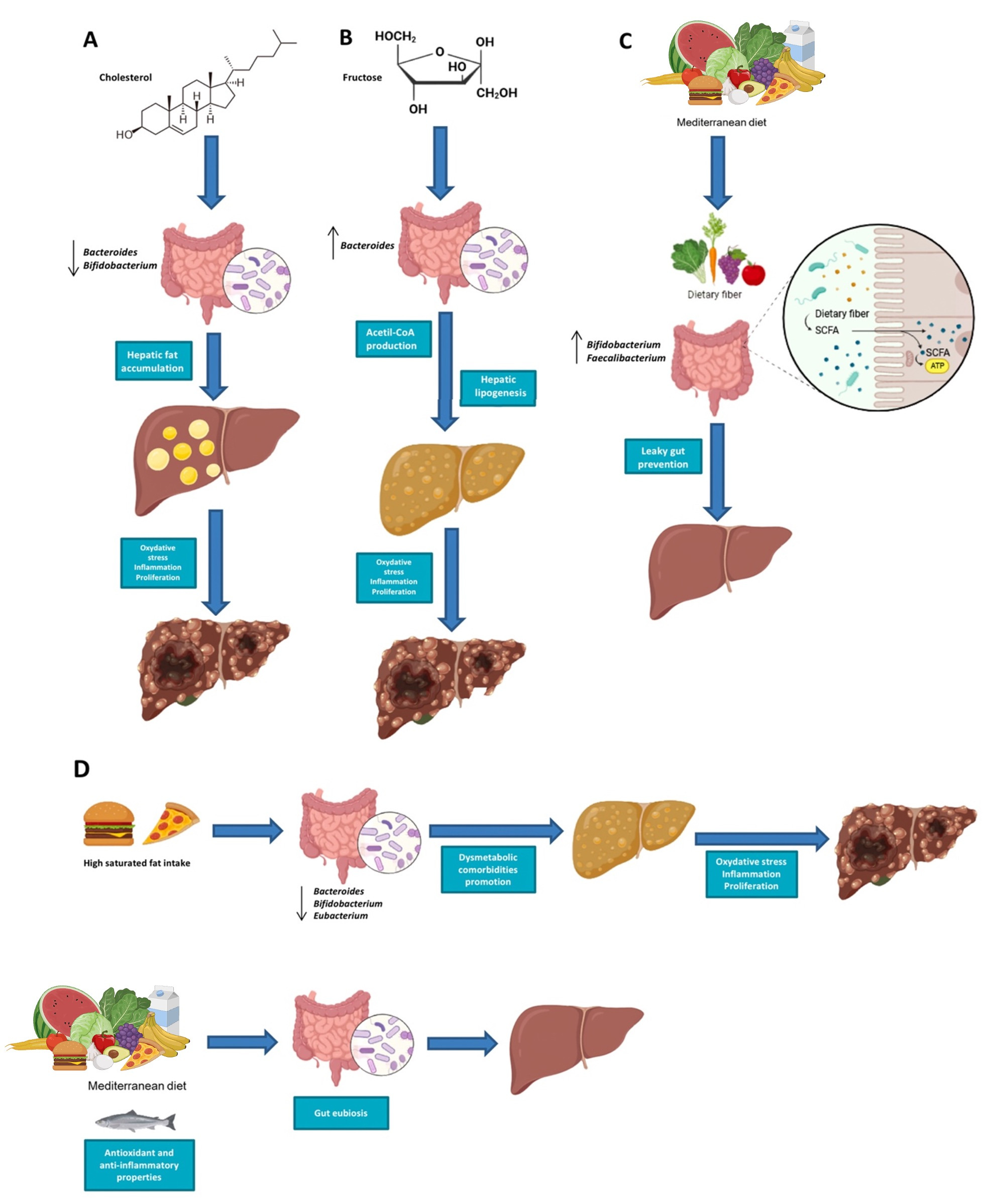 Impact of diet and gut microbiota changes in the development of hepatocellular carcinoma