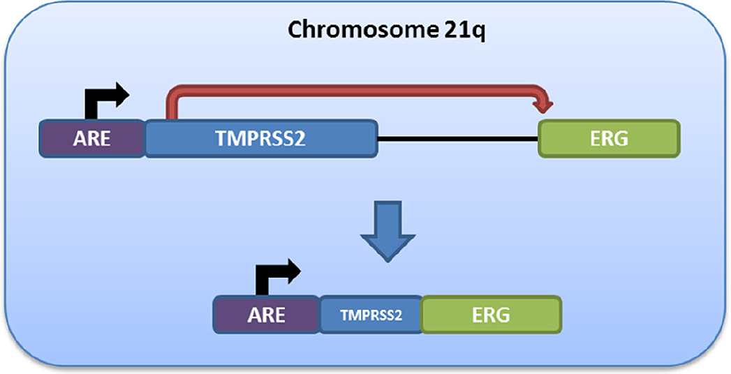 The somatic clinico-genomics of localized, non-indolent prostate cancer