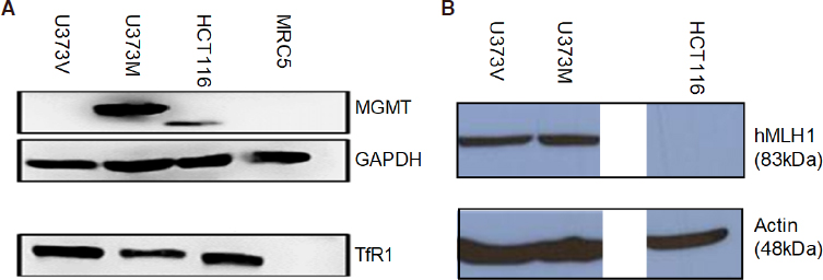 In search of effective therapies to overcome resistance to Temozolomide in brain tumours