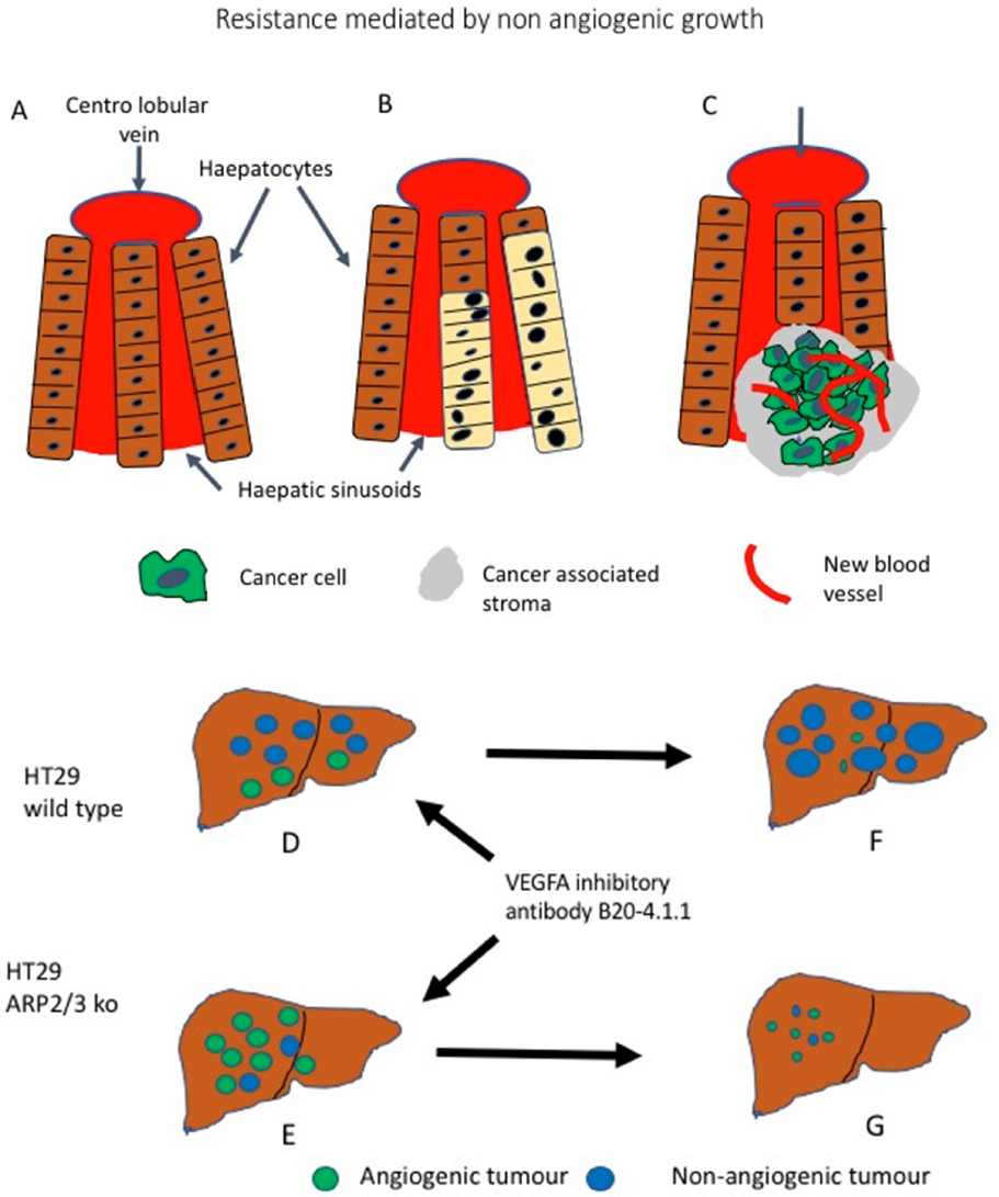 Mechanisms of resistance to anti-angiogenic treatments