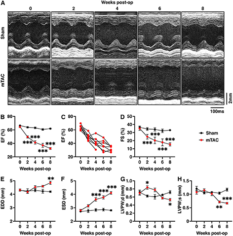 Characterization of atrial and ventricular remodeling in an improved minimally invasive mouse model of transverse aortic constriction