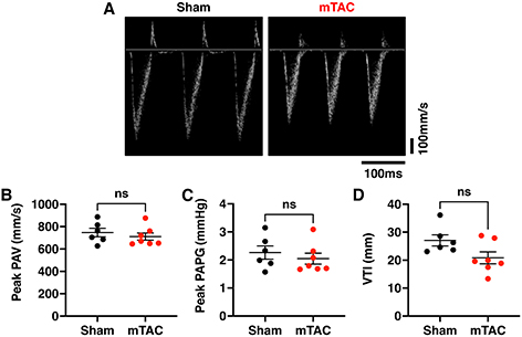 Characterization of atrial and ventricular remodeling in an improved minimally invasive mouse model of transverse aortic constriction
