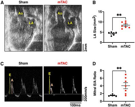 Characterization of atrial and ventricular remodeling in an improved minimally invasive mouse model of transverse aortic constriction