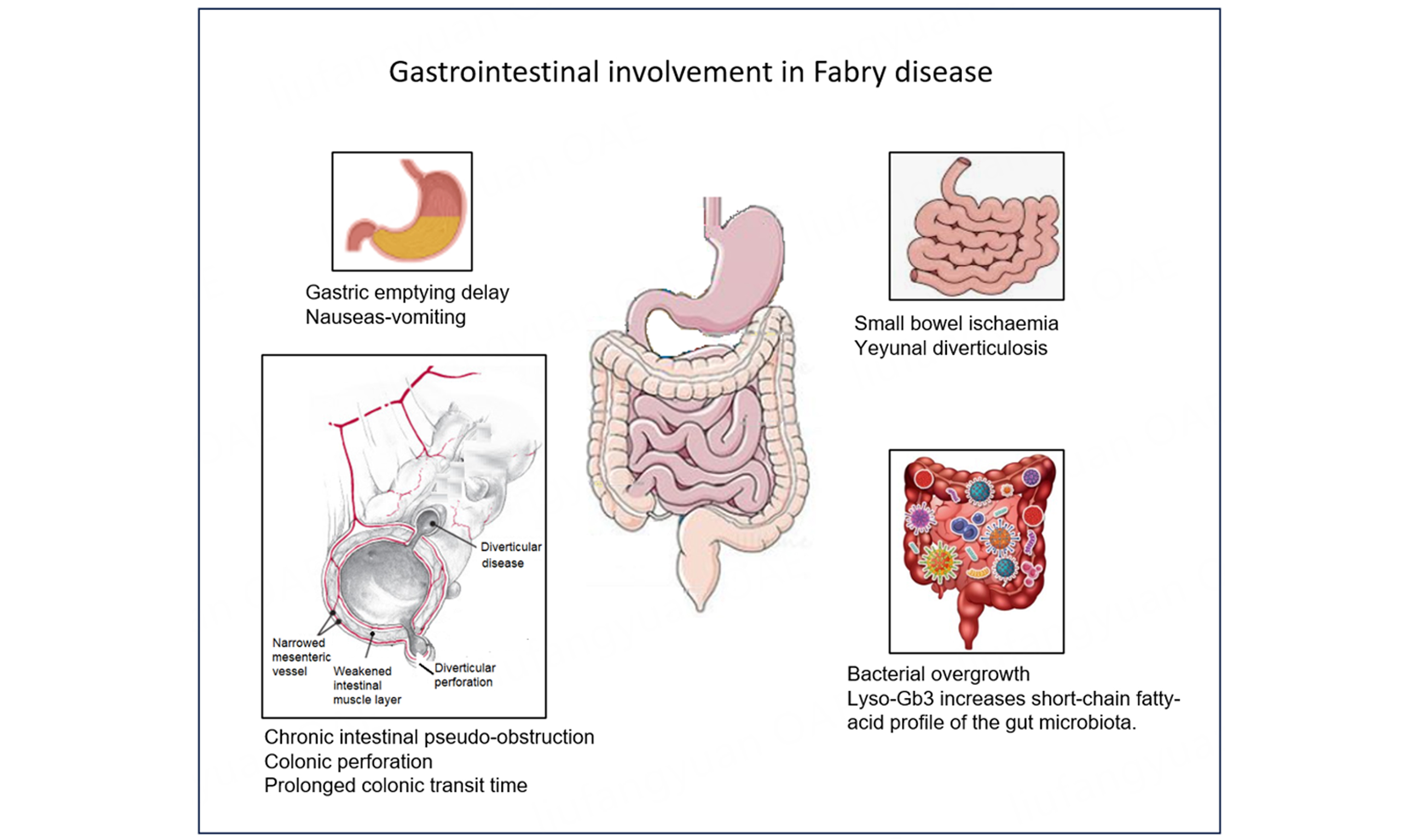 Topic: Advancements in Diagnosis and Treatment of Fabry Disease 1.0