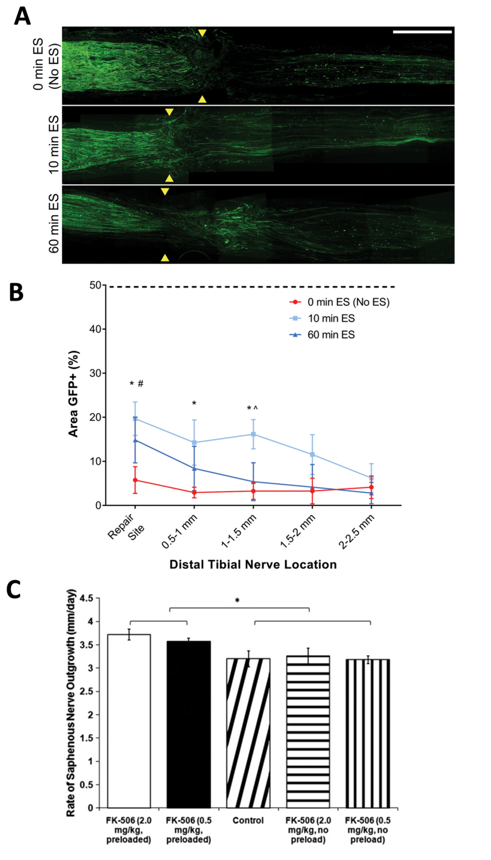 Therapeutic strategies for peripheral nerve injuries: FK506 and electrostimulation
