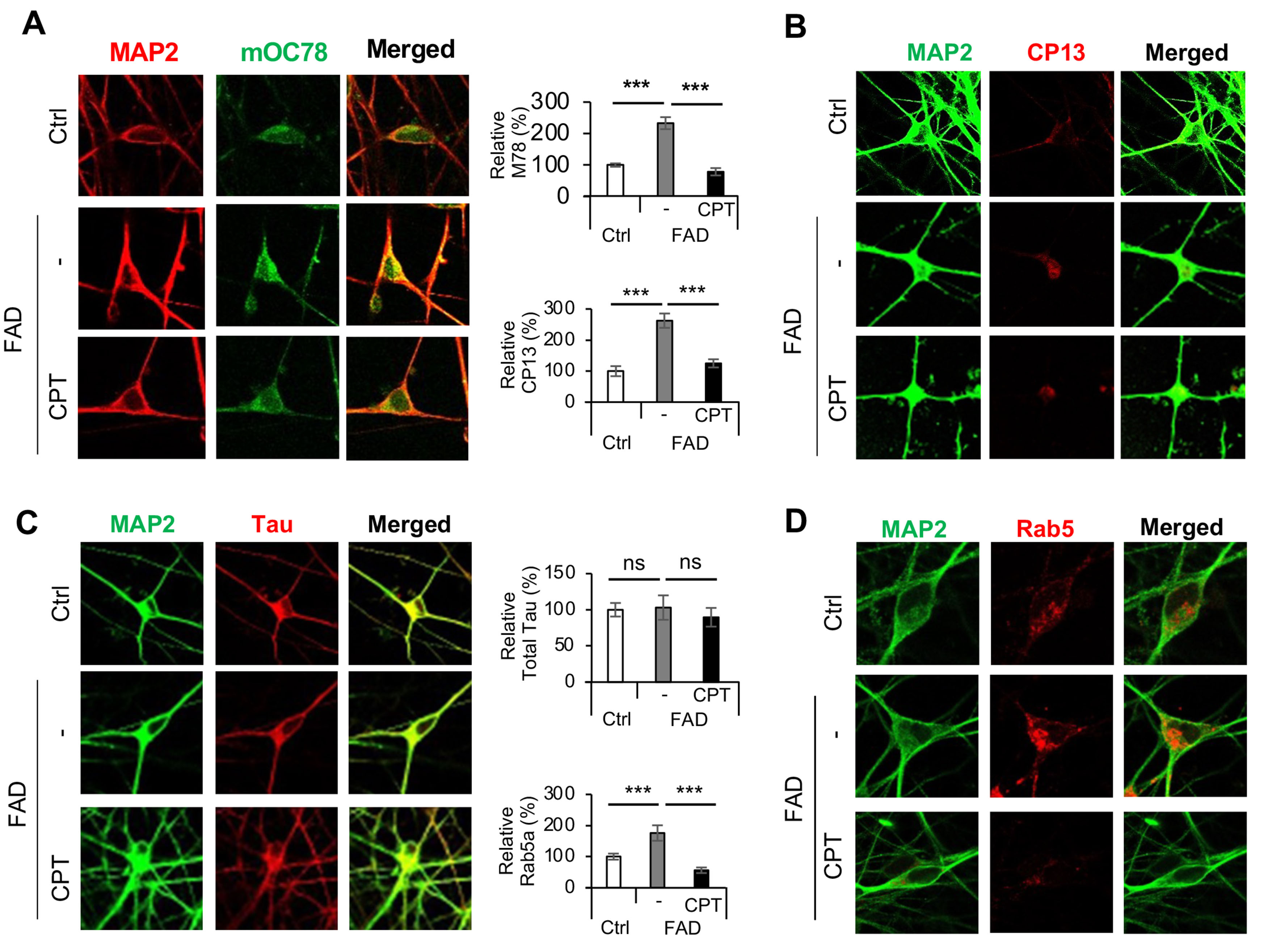 Deregulation of mitochondrial reverse electron transport alters the metabolism of reactive oxygen species and NAD<sup>+</sup>/NADH and presents a therapeutic target in Alzheimer's disease