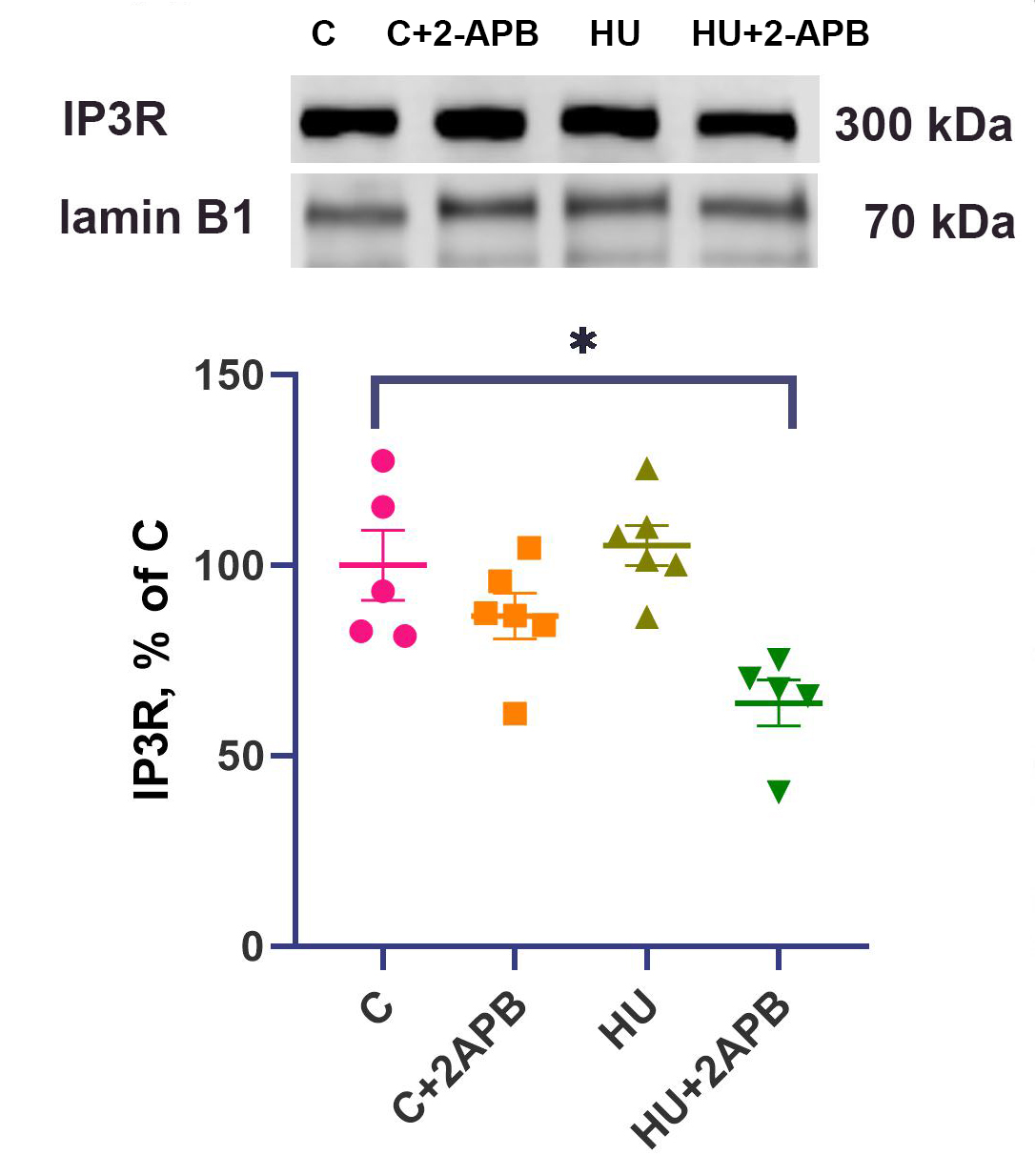 IP3 receptors contribute to muscle atrophy and maintain ribosomal RNA content during 3-day hind limb suspension in rats