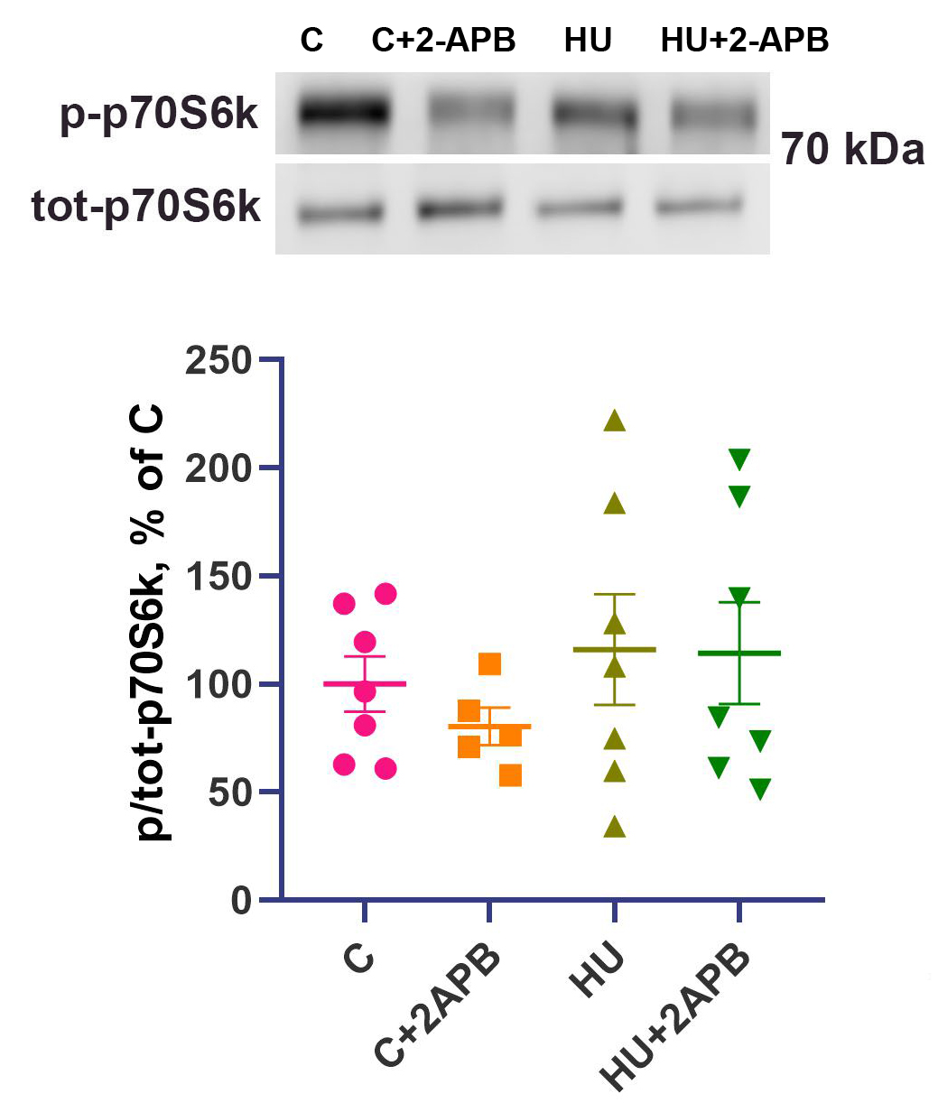 IP3 receptors contribute to muscle atrophy and maintain ribosomal RNA content during 3-day hind limb suspension in rats