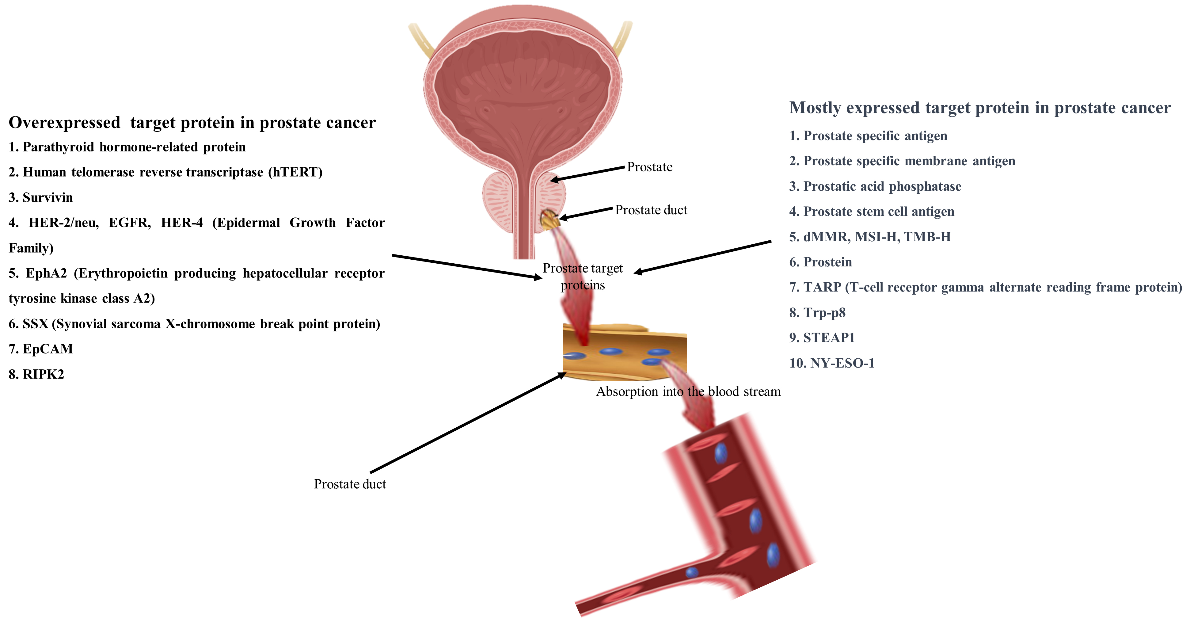 New approaches and prospects of immunotherapy and gene therapy for prostate cancer