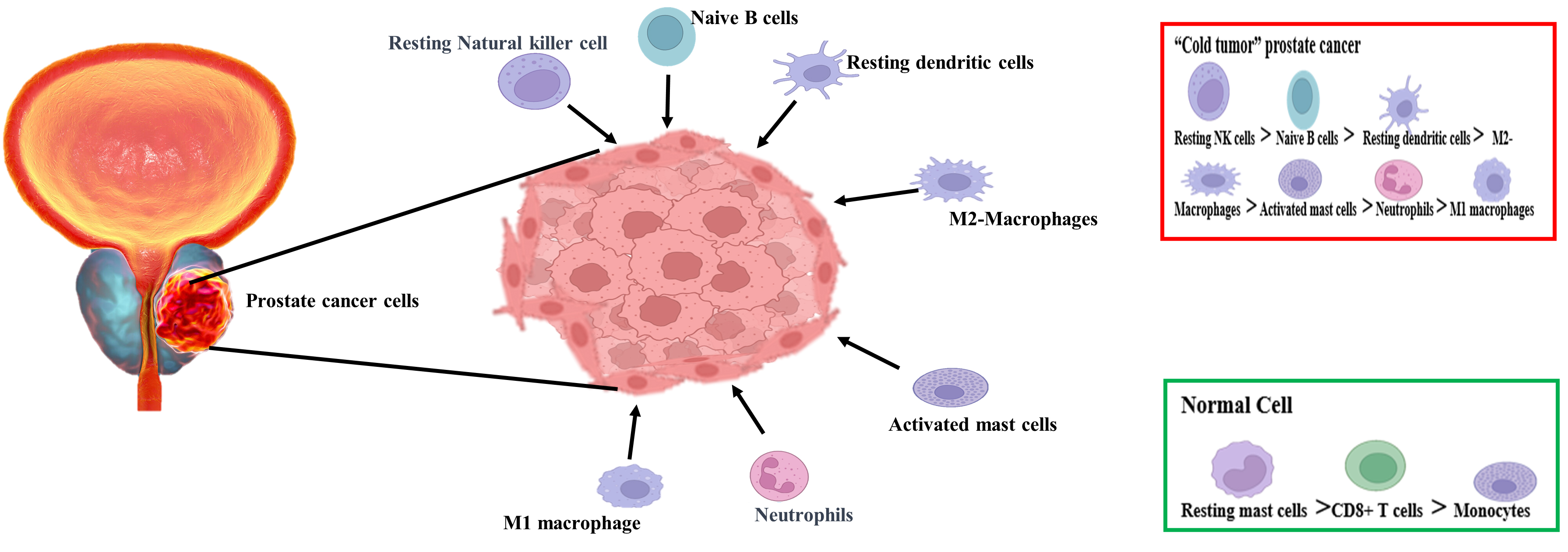 New approaches and prospects of immunotherapy and gene therapy for prostate cancer