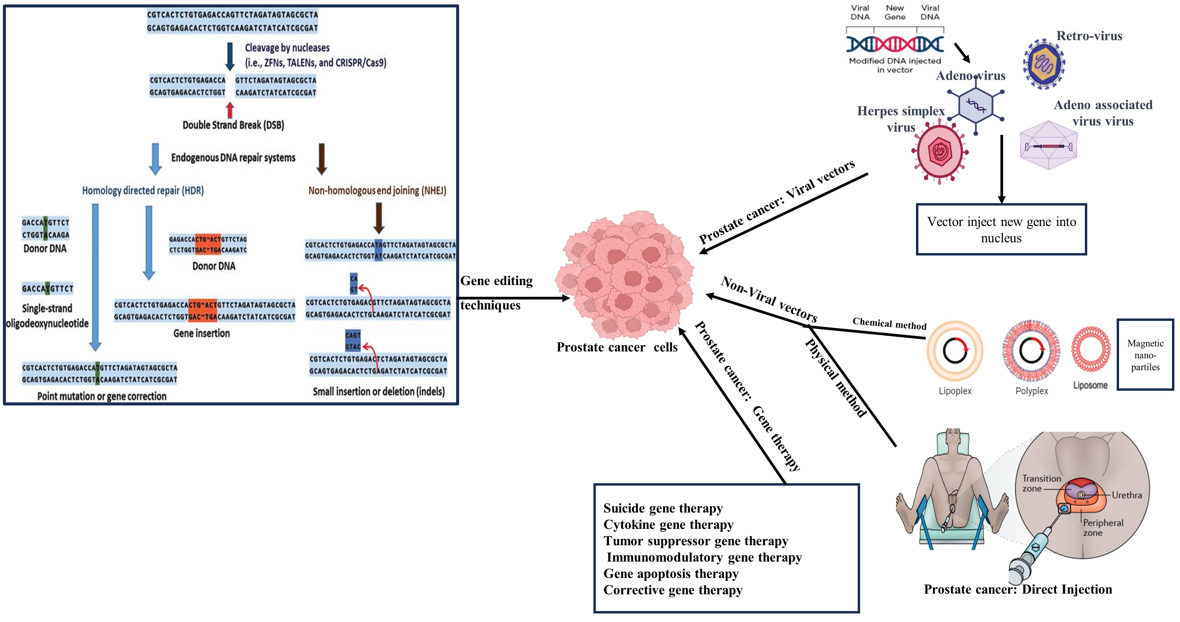 New approaches and prospects of immunotherapy and gene therapy for prostate cancer