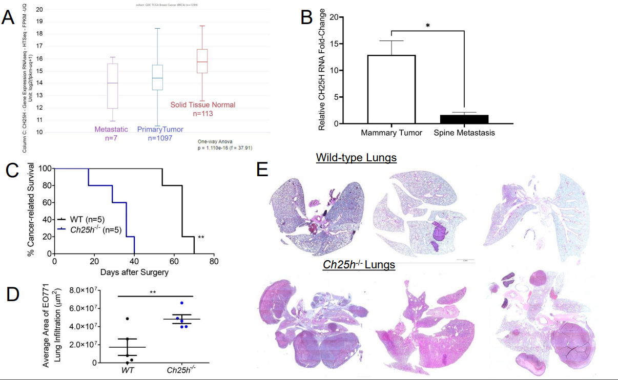 NUPR1 packaged in extracellular vesicles promotes murine triple-negative breast cancer in a type 1 interferon-independent manner