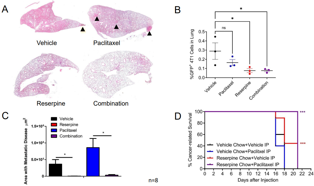 NUPR1 packaged in extracellular vesicles promotes murine triple-negative breast cancer in a type 1 interferon-independent manner