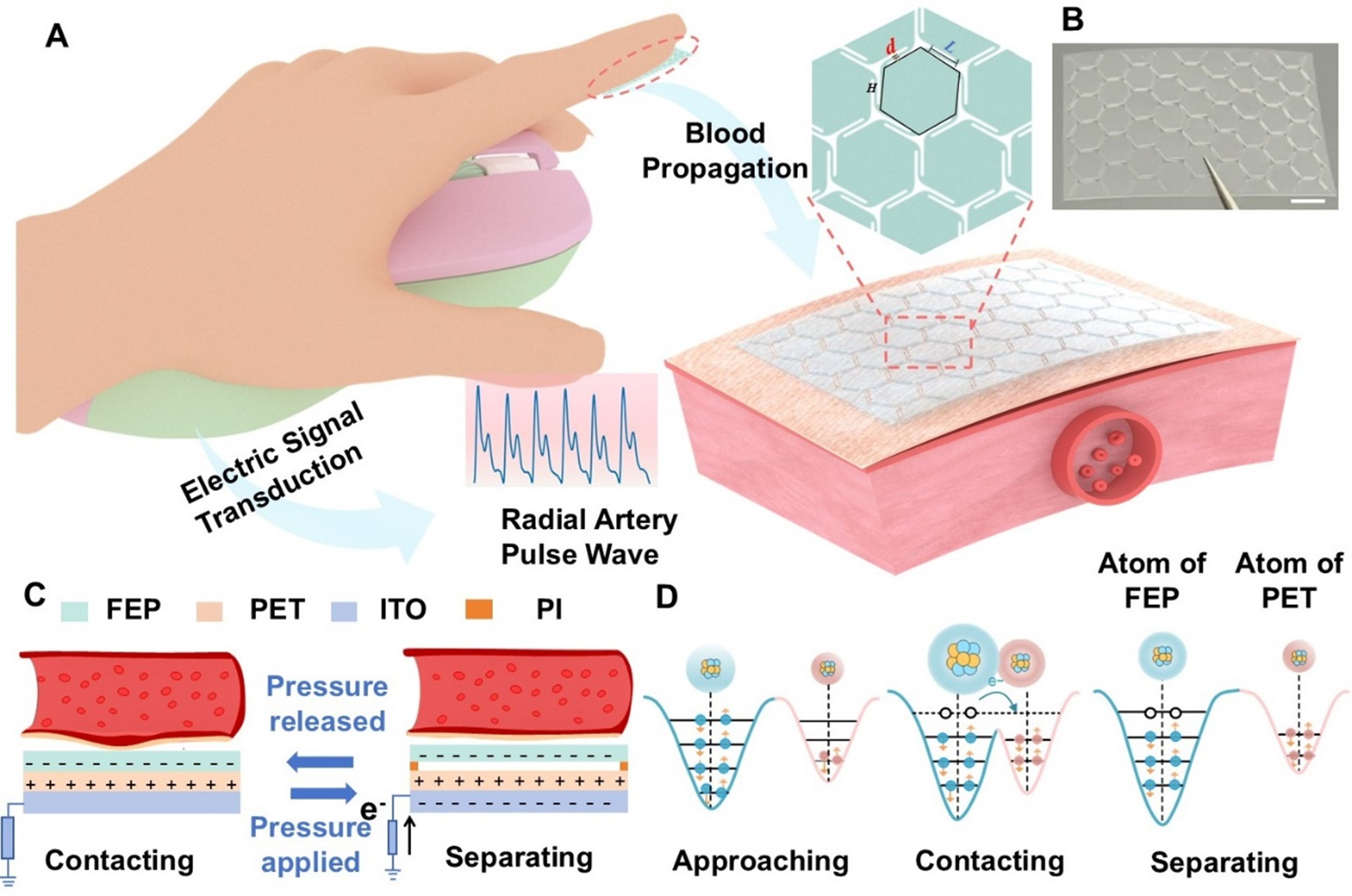 Island-bridge microstructured triboelectric pressure sensor for effective dynamic epidermal pulse monitoring