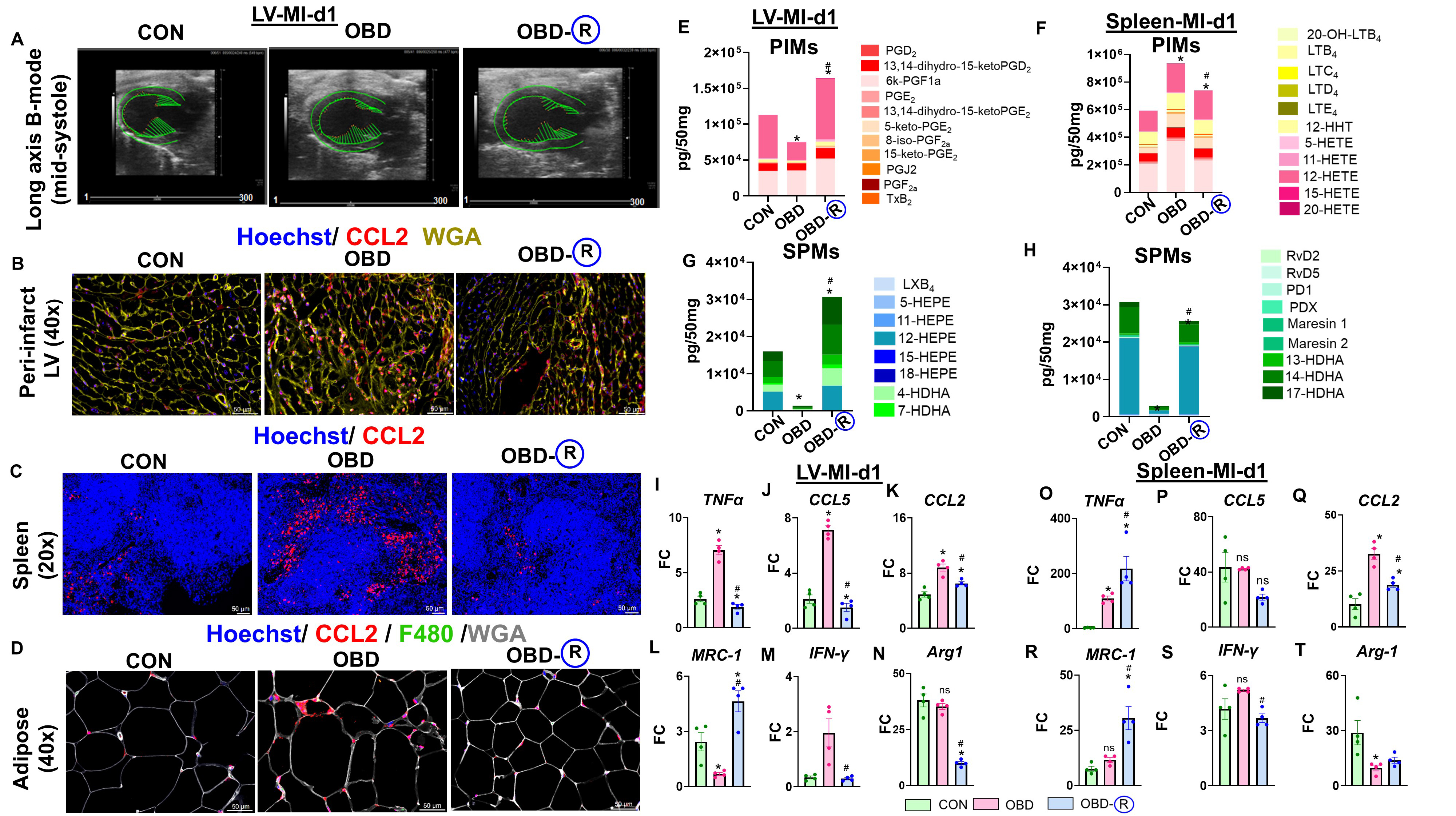 Reversing an obesogenic diet to control diet partially rescues pro-inflammatory lipid-immune memory in splenocardiac aging