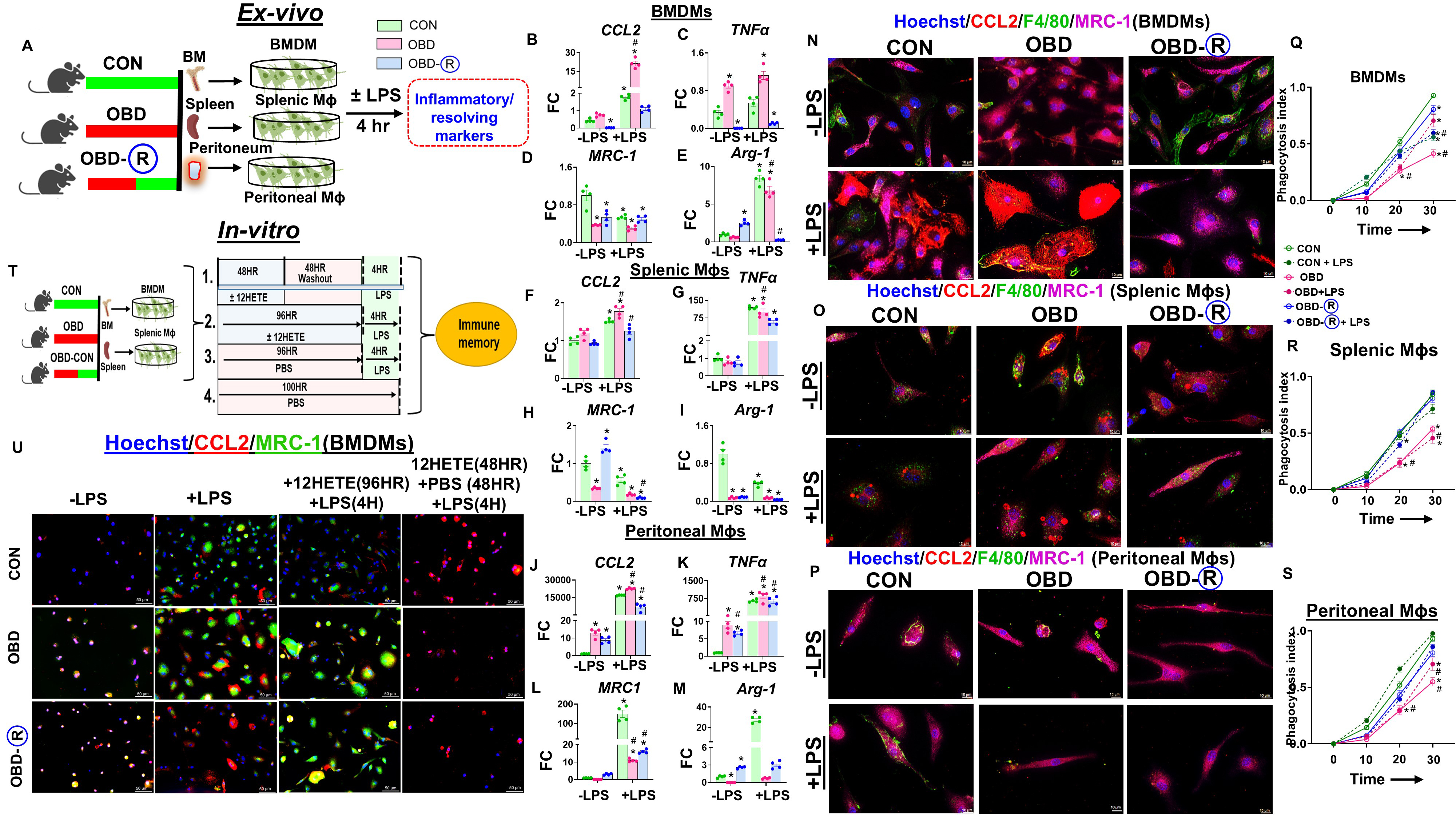 Reversing an obesogenic diet to control diet partially rescues pro-inflammatory lipid-immune memory in splenocardiac aging