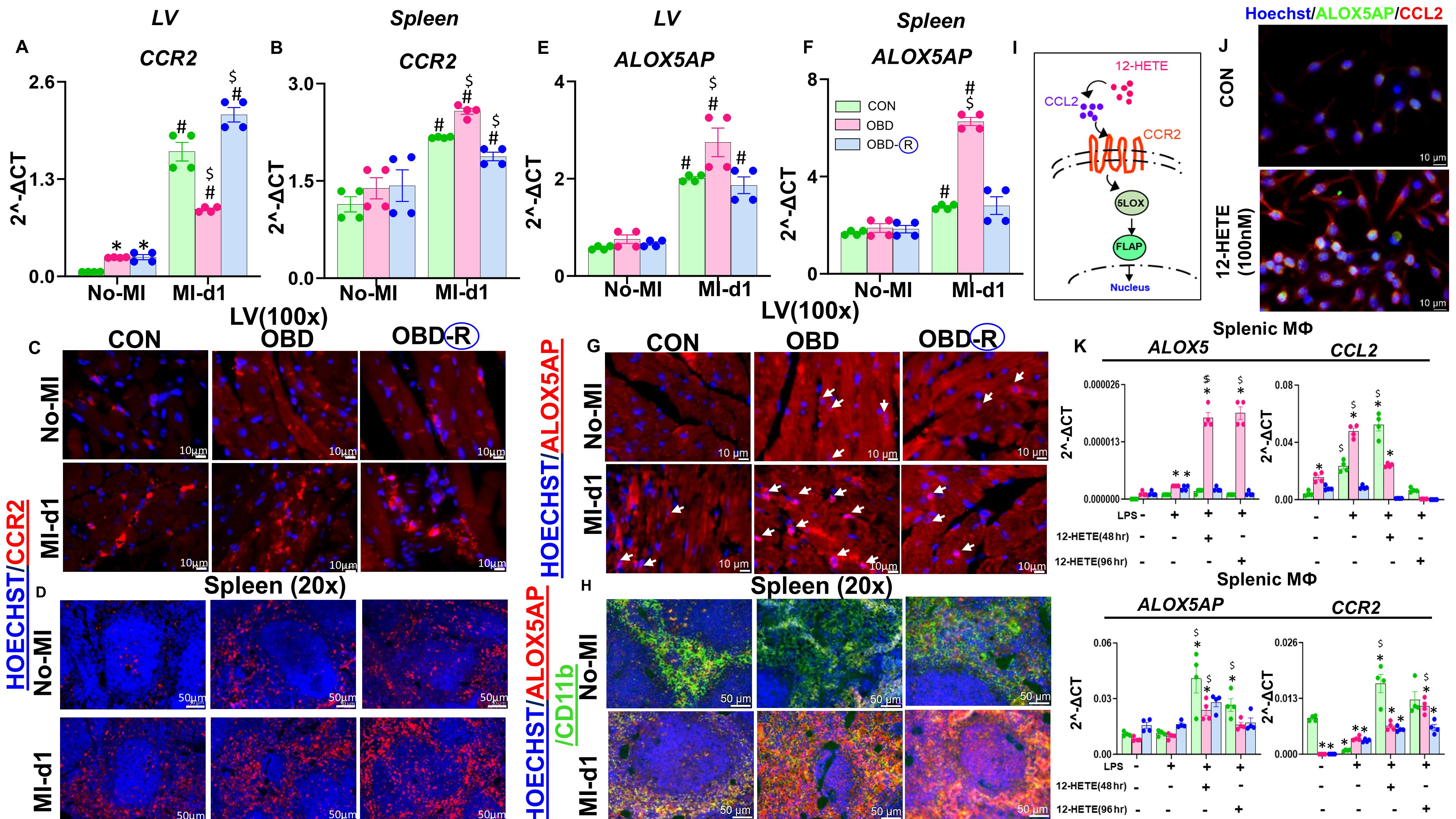 Reversing an obesogenic diet to control diet partially rescues pro-inflammatory lipid-immune memory in splenocardiac aging