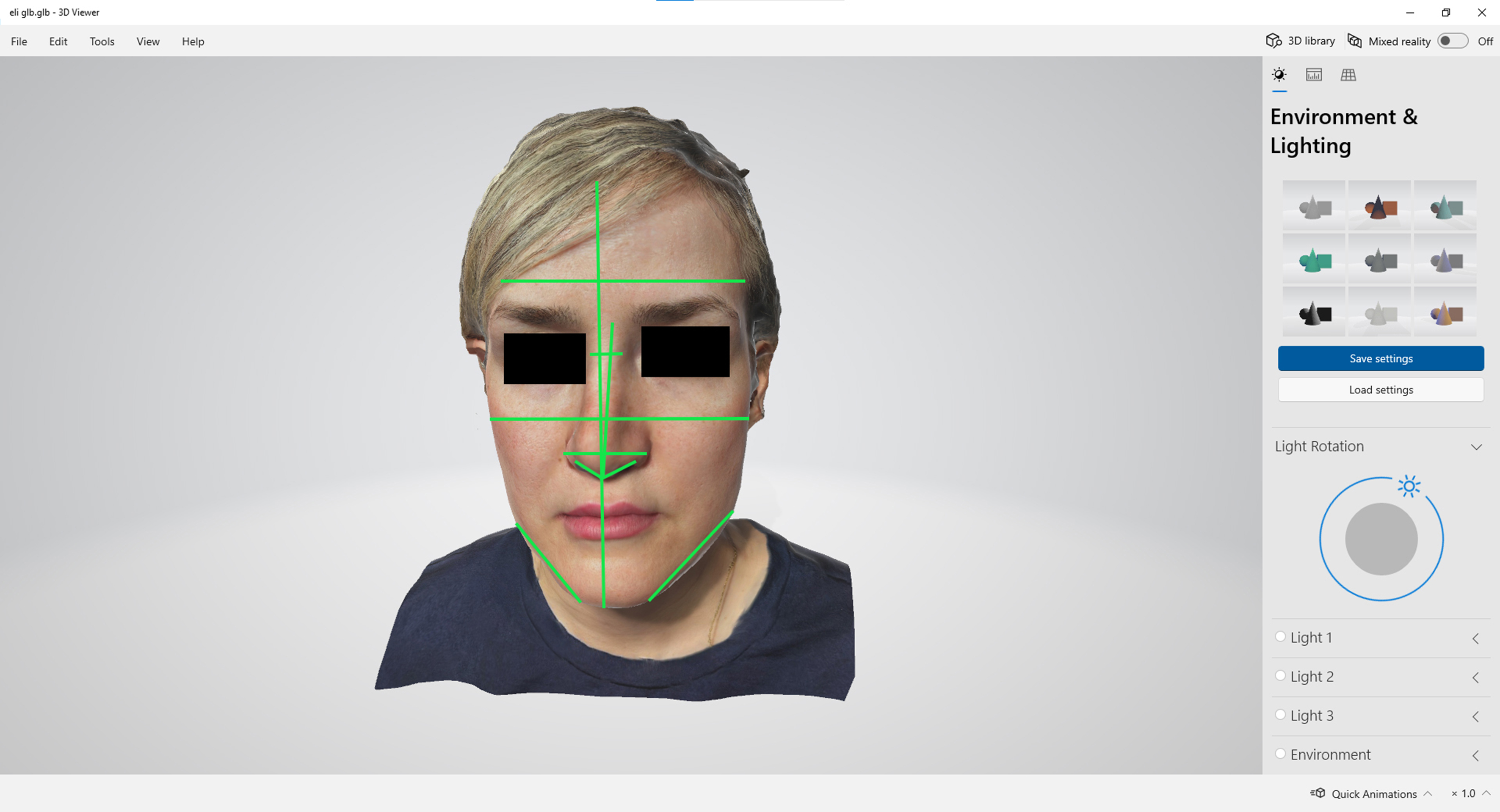 Intelligent augmented reality application for personalised rhinoplasty using machine learning