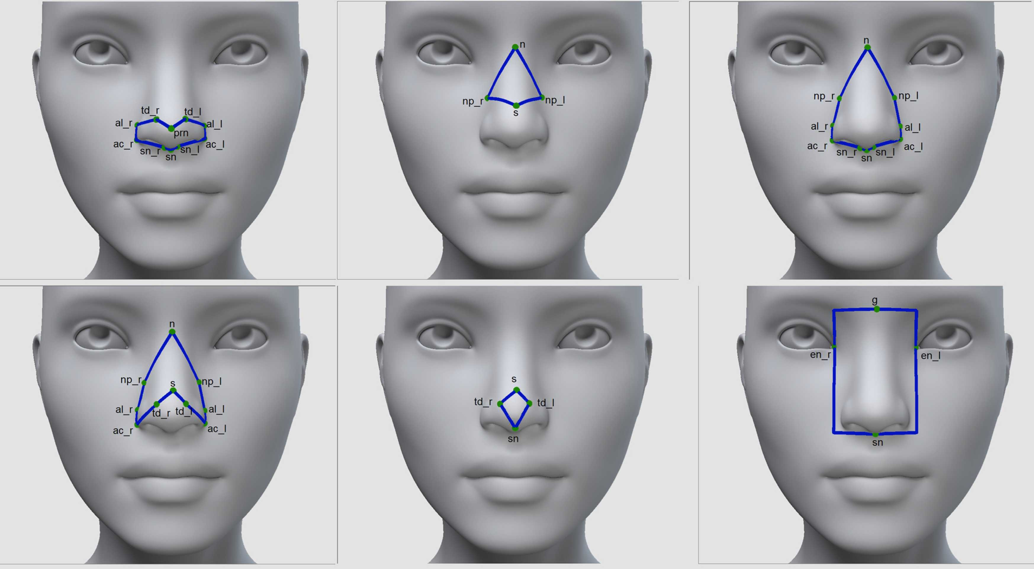 Intelligent augmented reality application for personalised rhinoplasty using machine learning