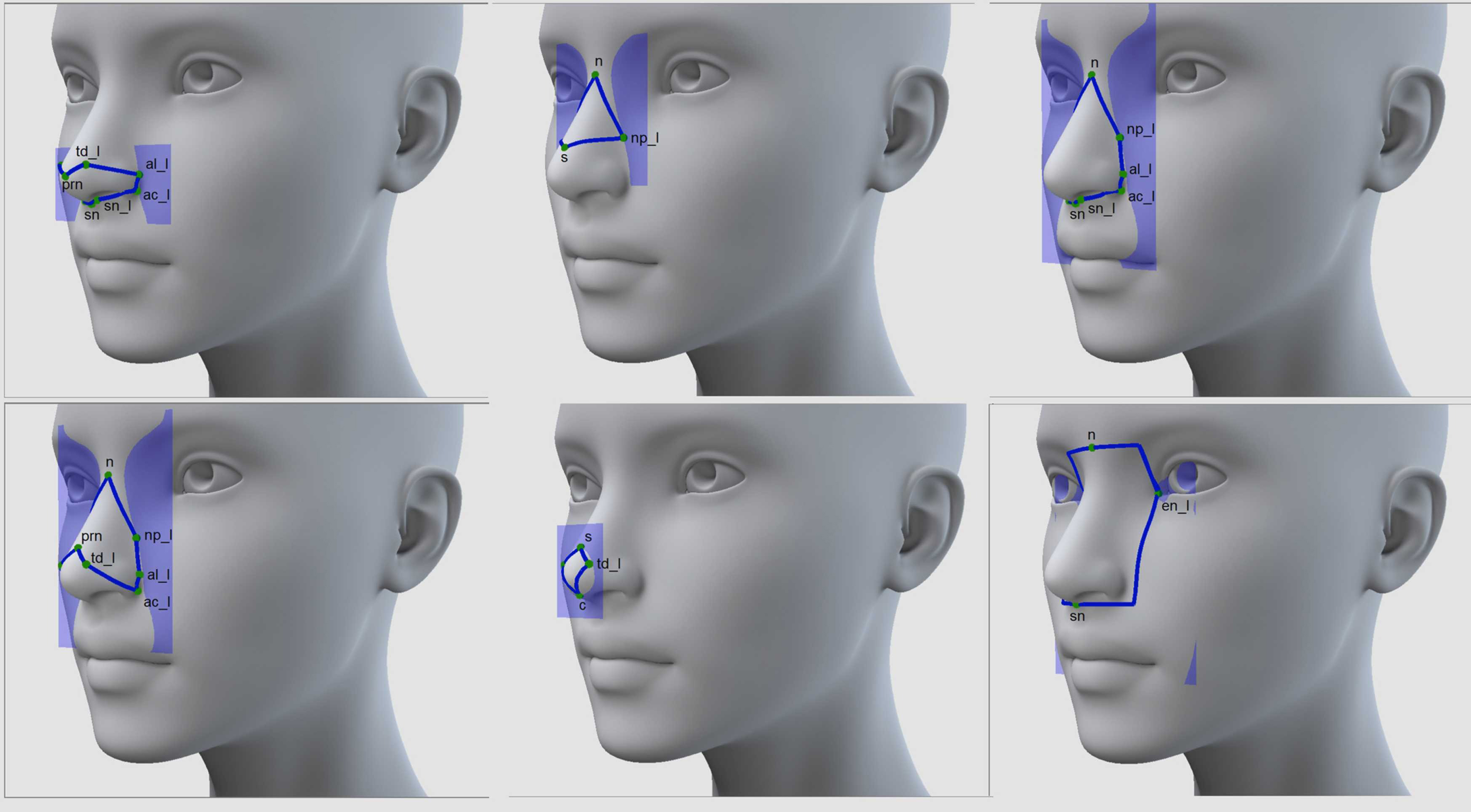 Intelligent augmented reality application for personalised rhinoplasty using machine learning
