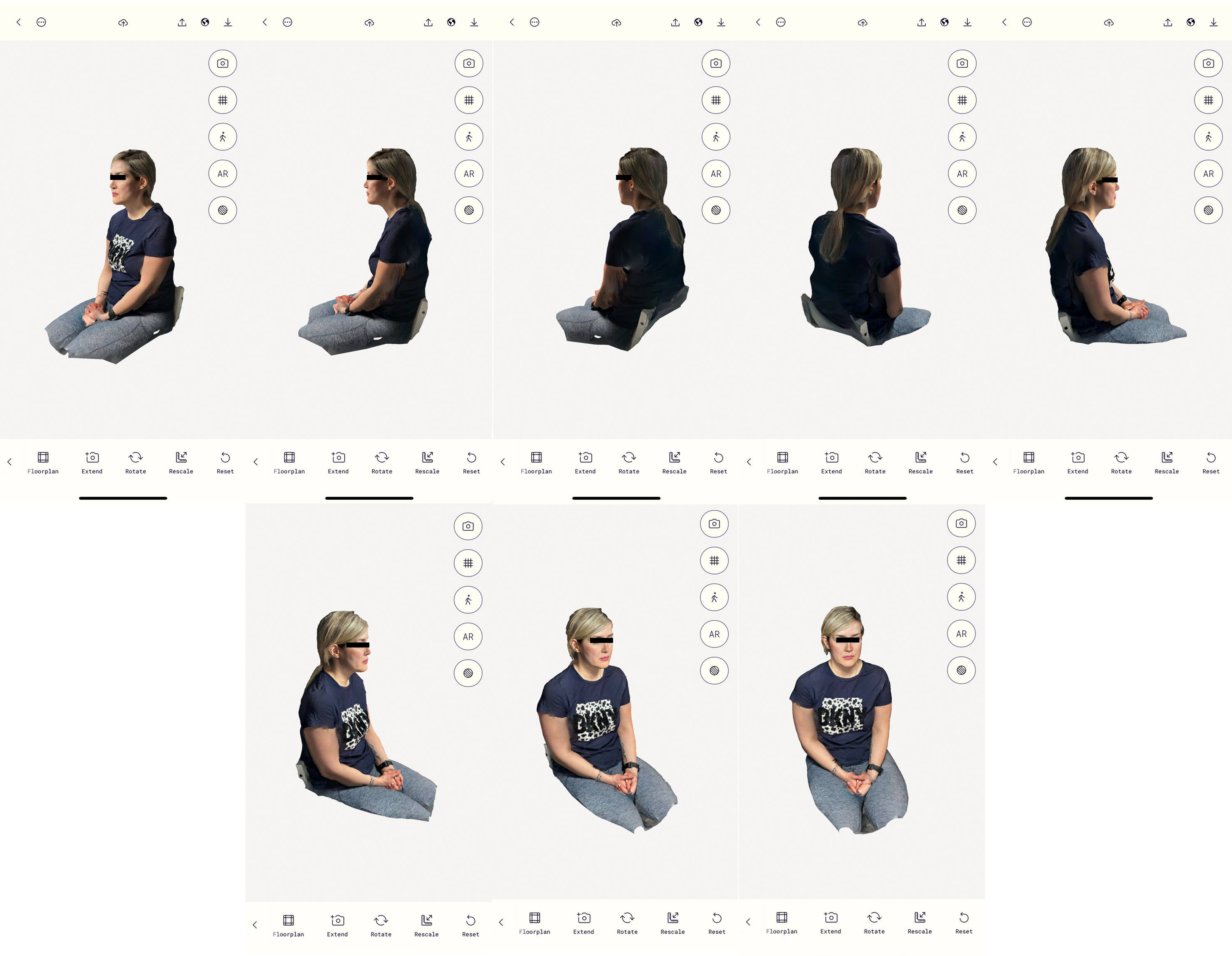 Intelligent augmented reality application for personalised rhinoplasty using machine learning