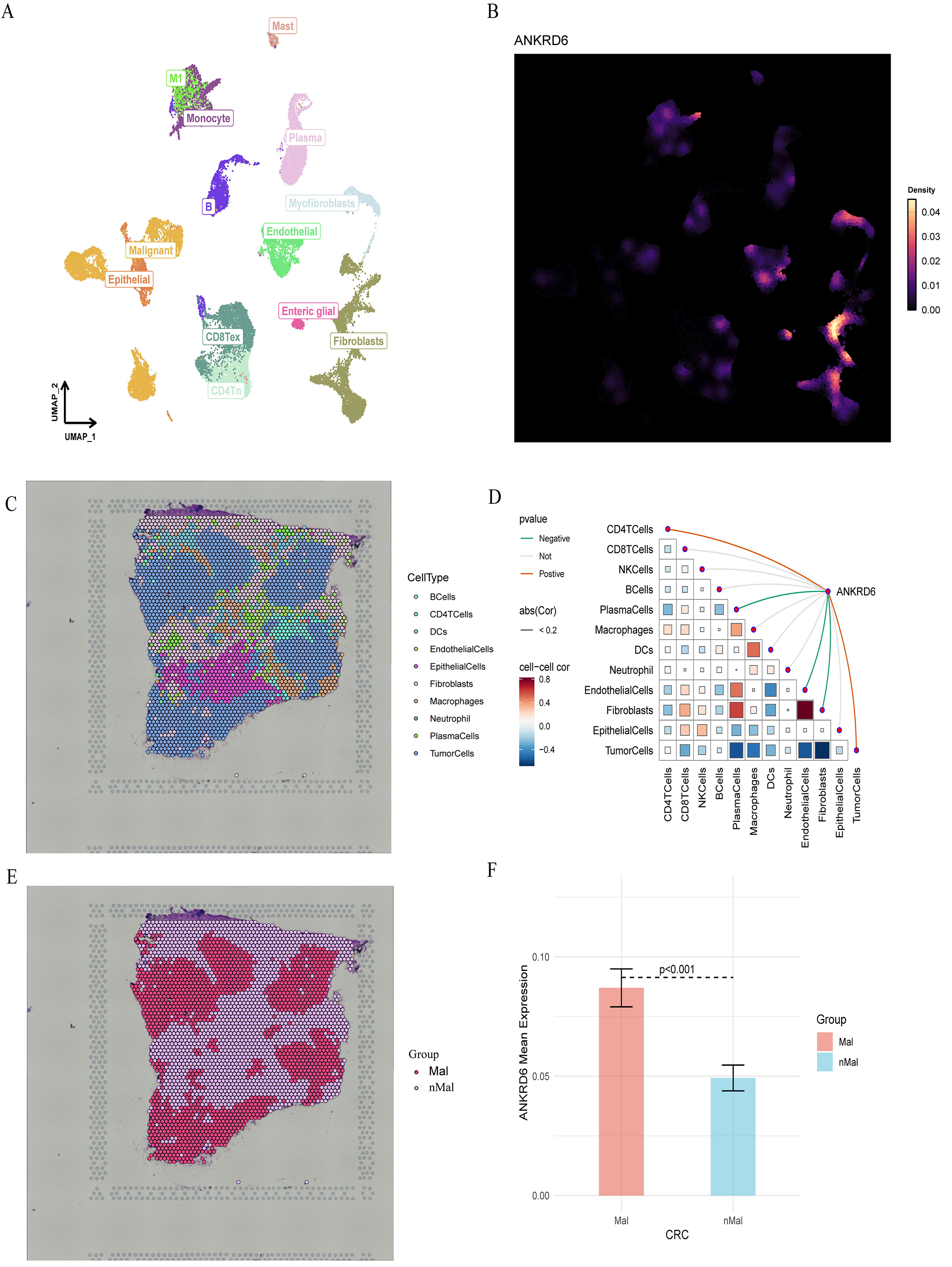 Differential expression and prognostic significance of ANKRD6 in colon adenocarcinoma: a pan-cancer analysis and pathway-specific investigation