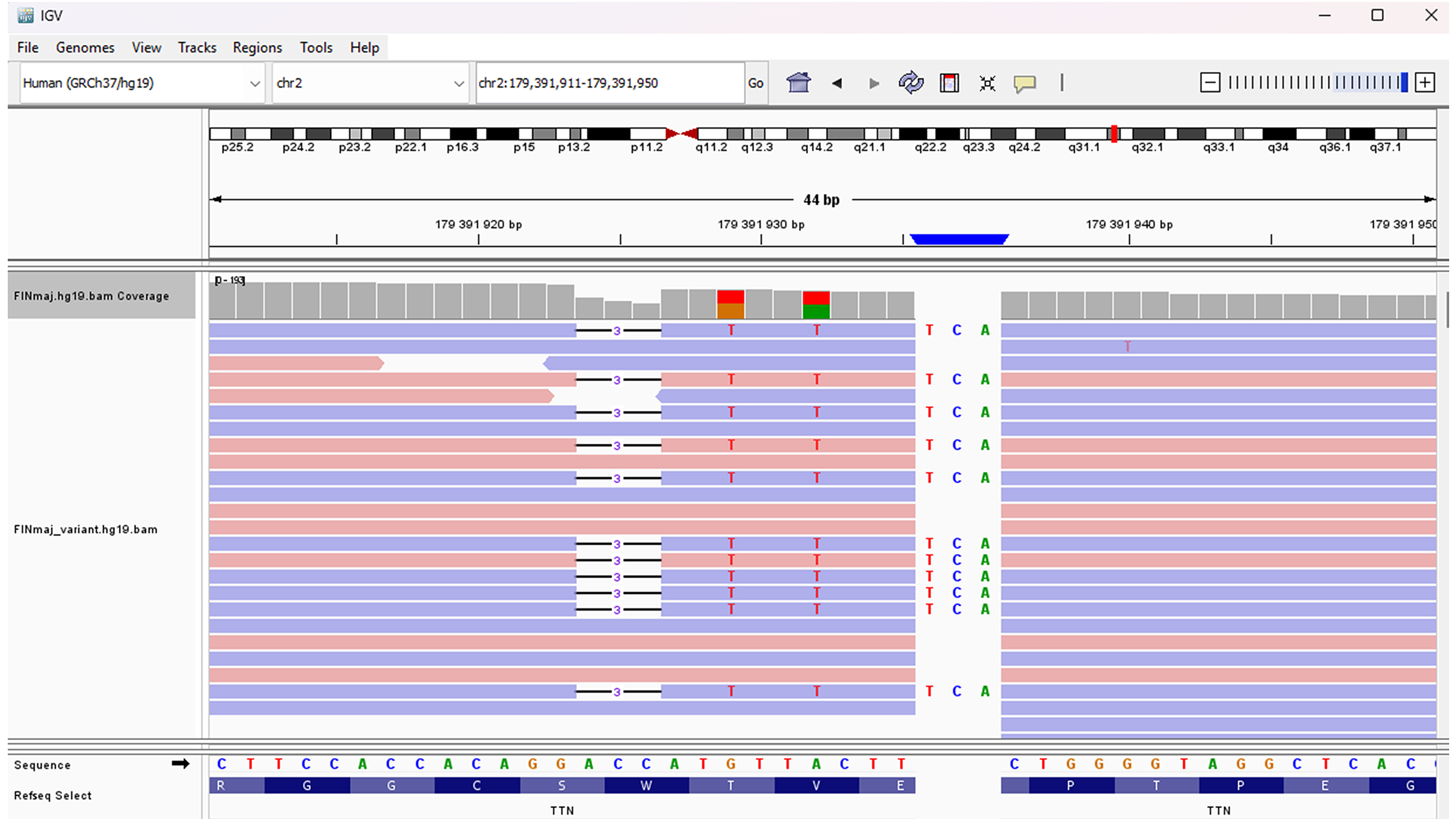 Autosomal dominant tibial muscular dystrophy in Estonia