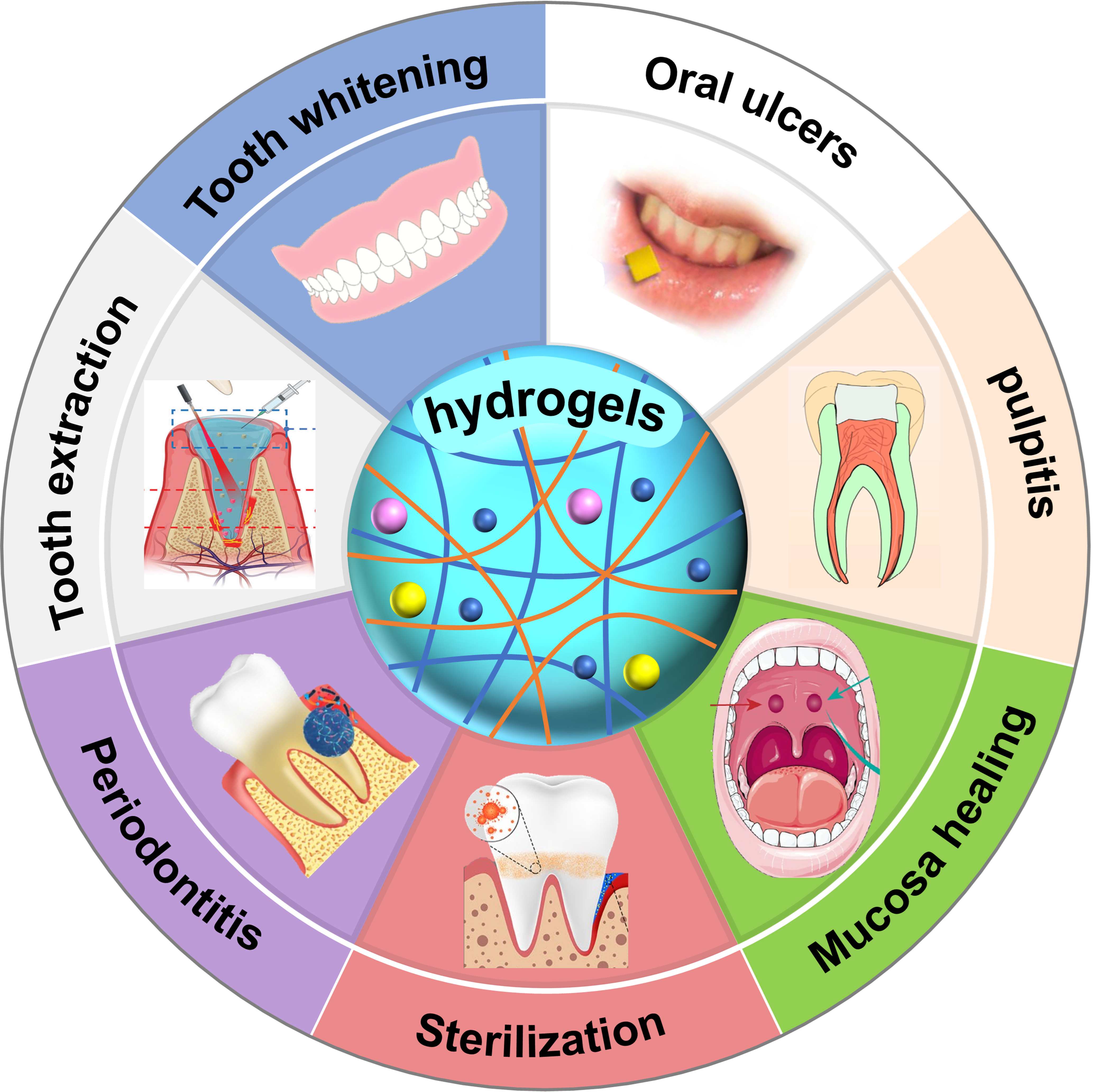 Functional hydrogels for dental disease treatment