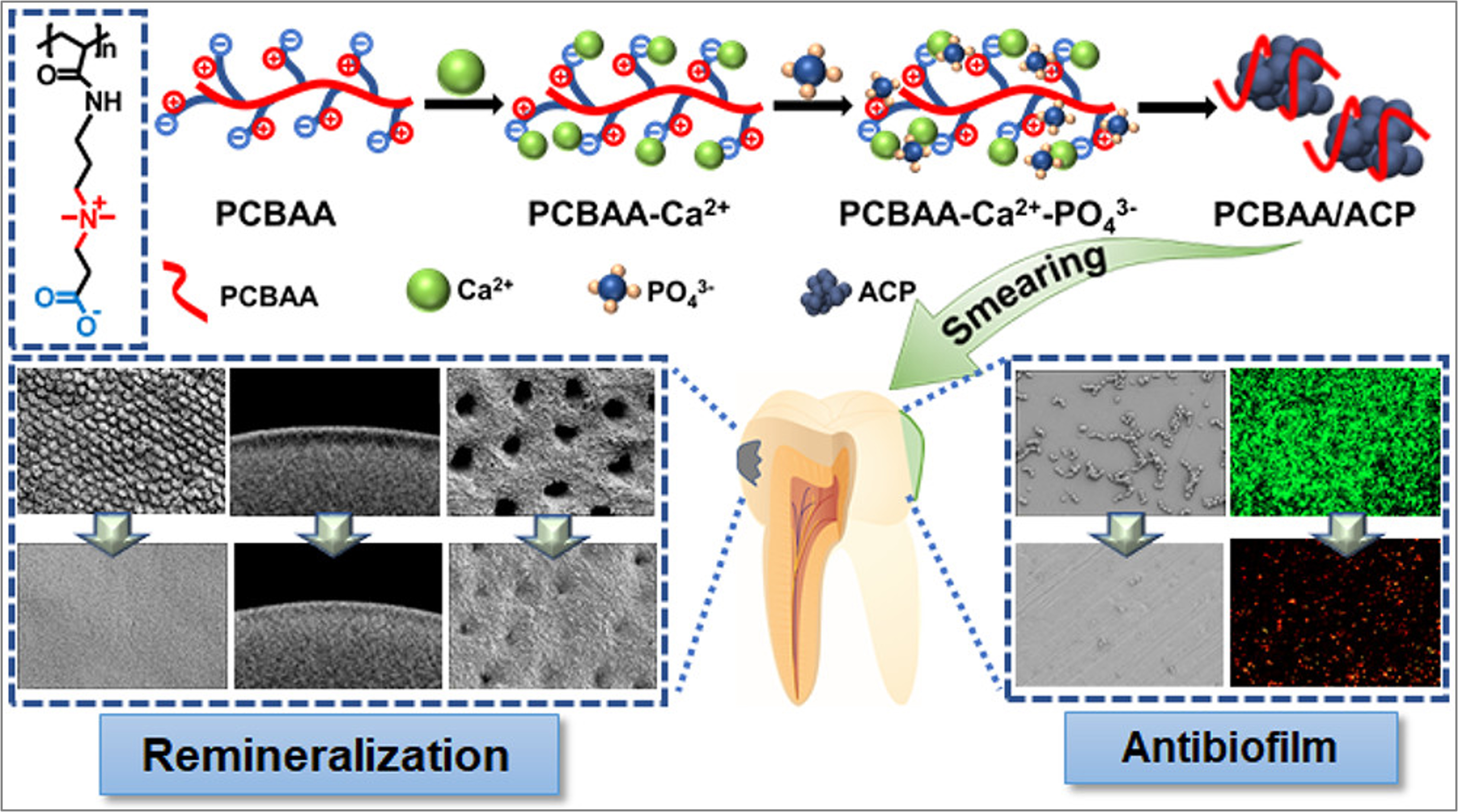 Functional hydrogels for dental disease treatment