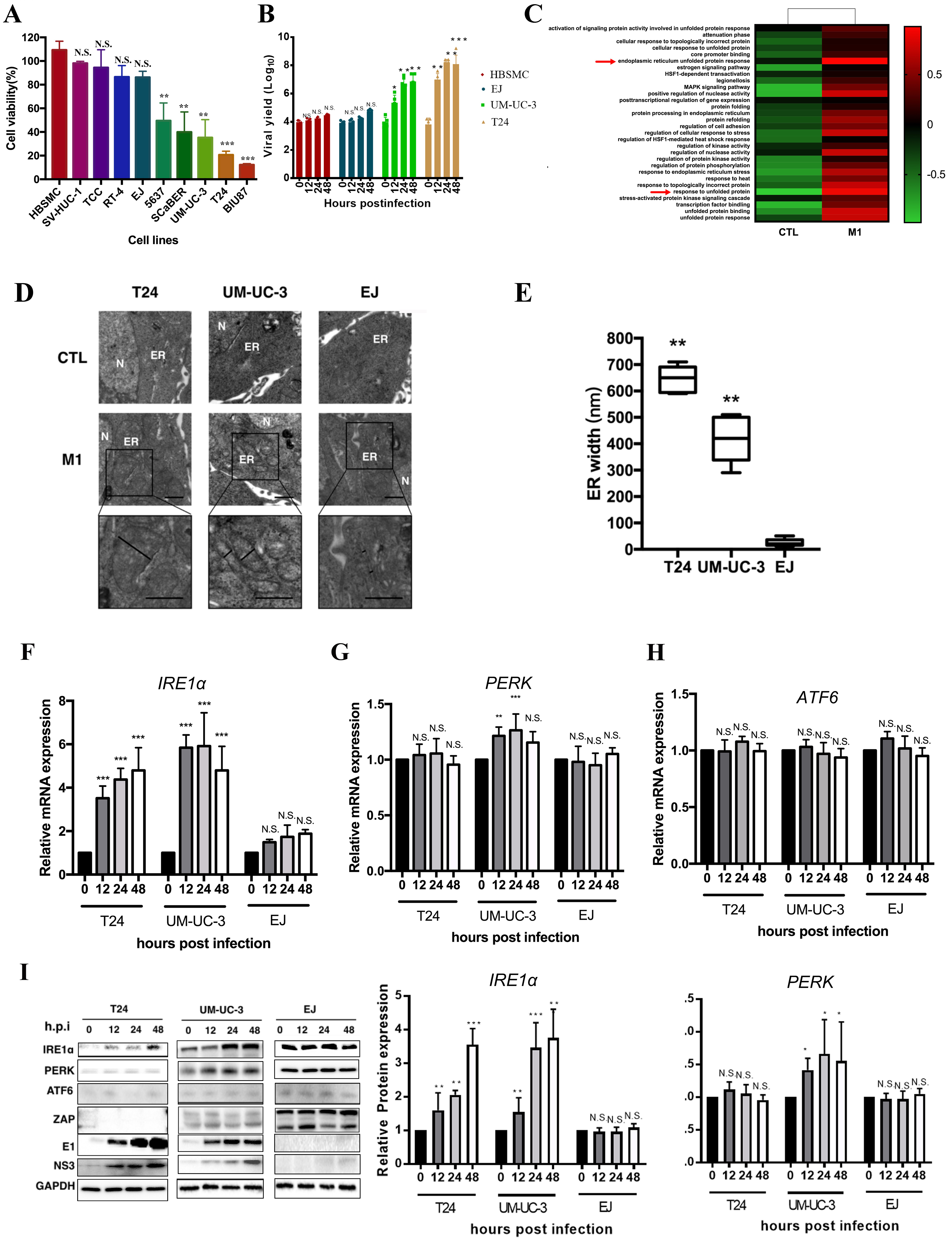 IRE1α modulates M1 oncolytic virus sensitivity via ER stress regulation in bladder cancer