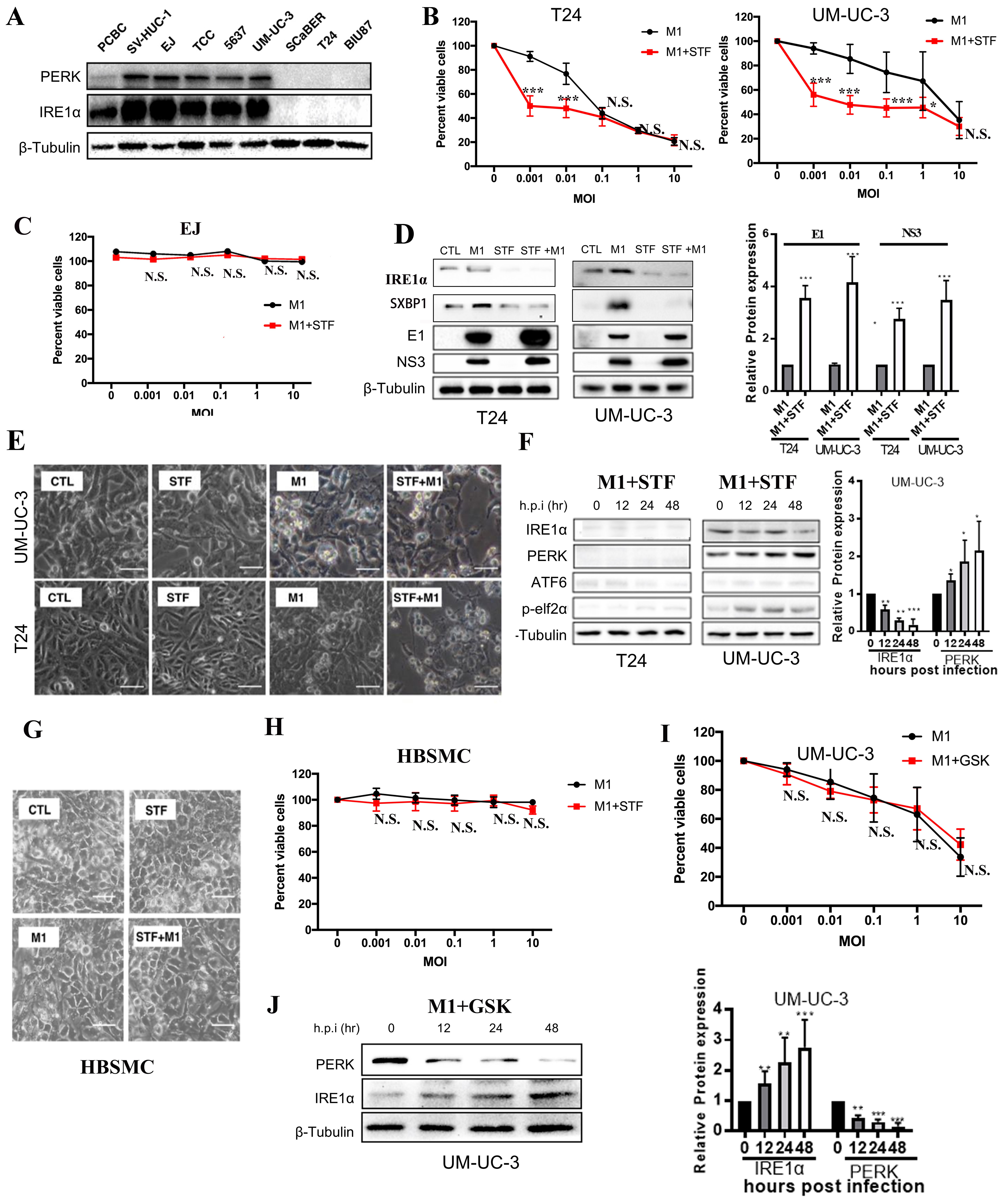 IRE1α modulates M1 oncolytic virus sensitivity via ER stress regulation in bladder cancer