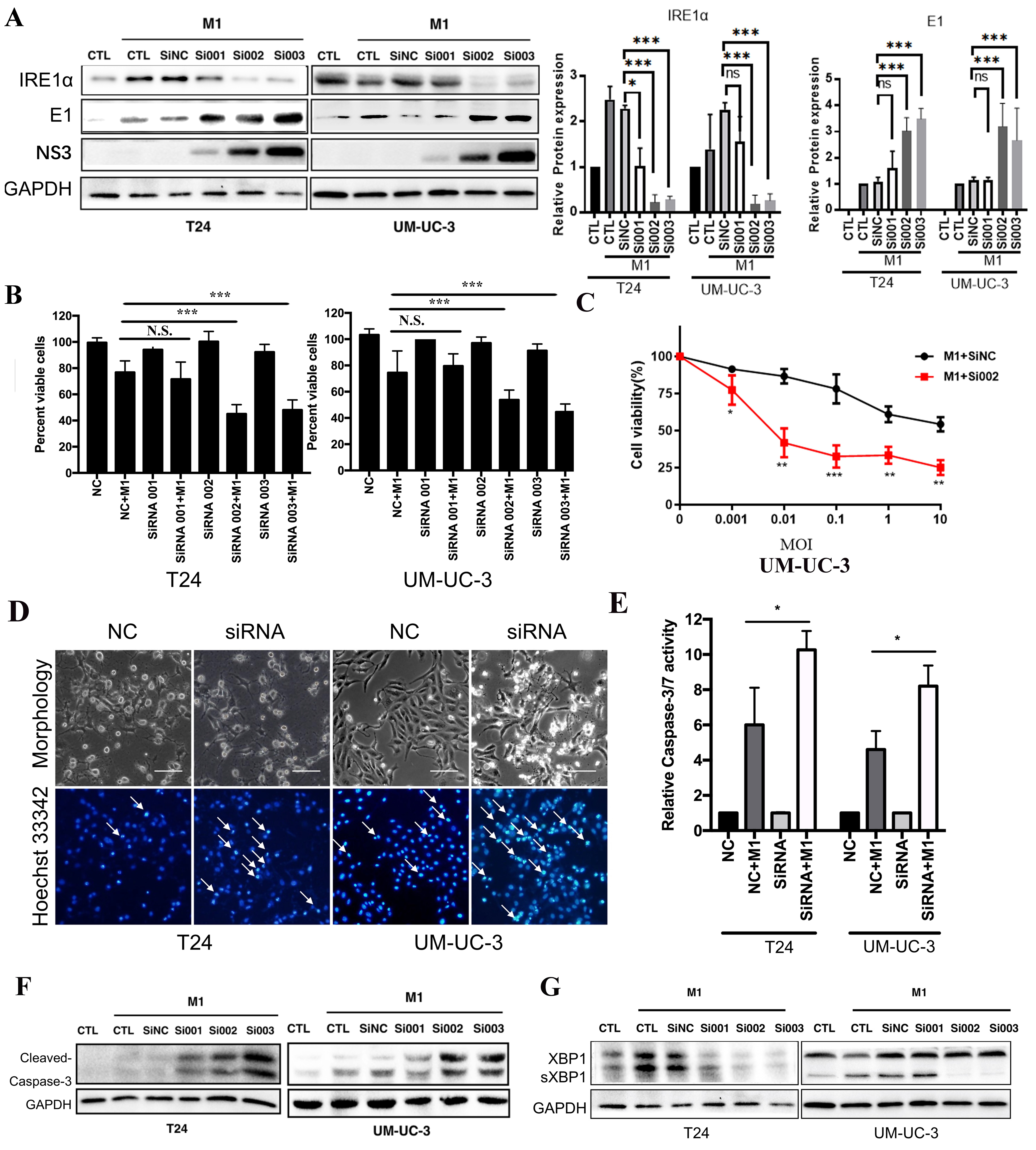 IRE1α modulates M1 oncolytic virus sensitivity via ER stress regulation in bladder cancer