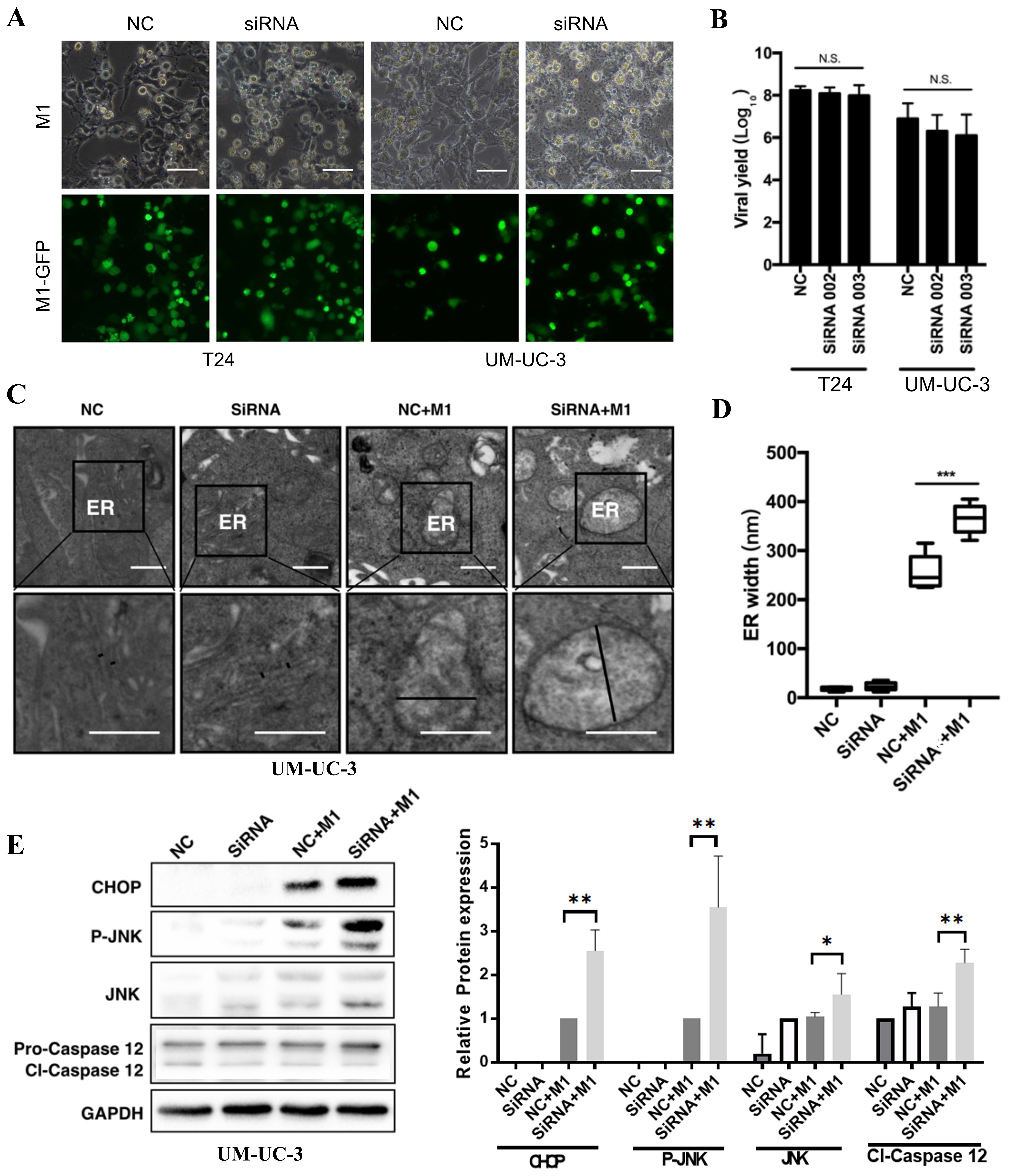 IRE1α modulates M1 oncolytic virus sensitivity via ER stress regulation in bladder cancer