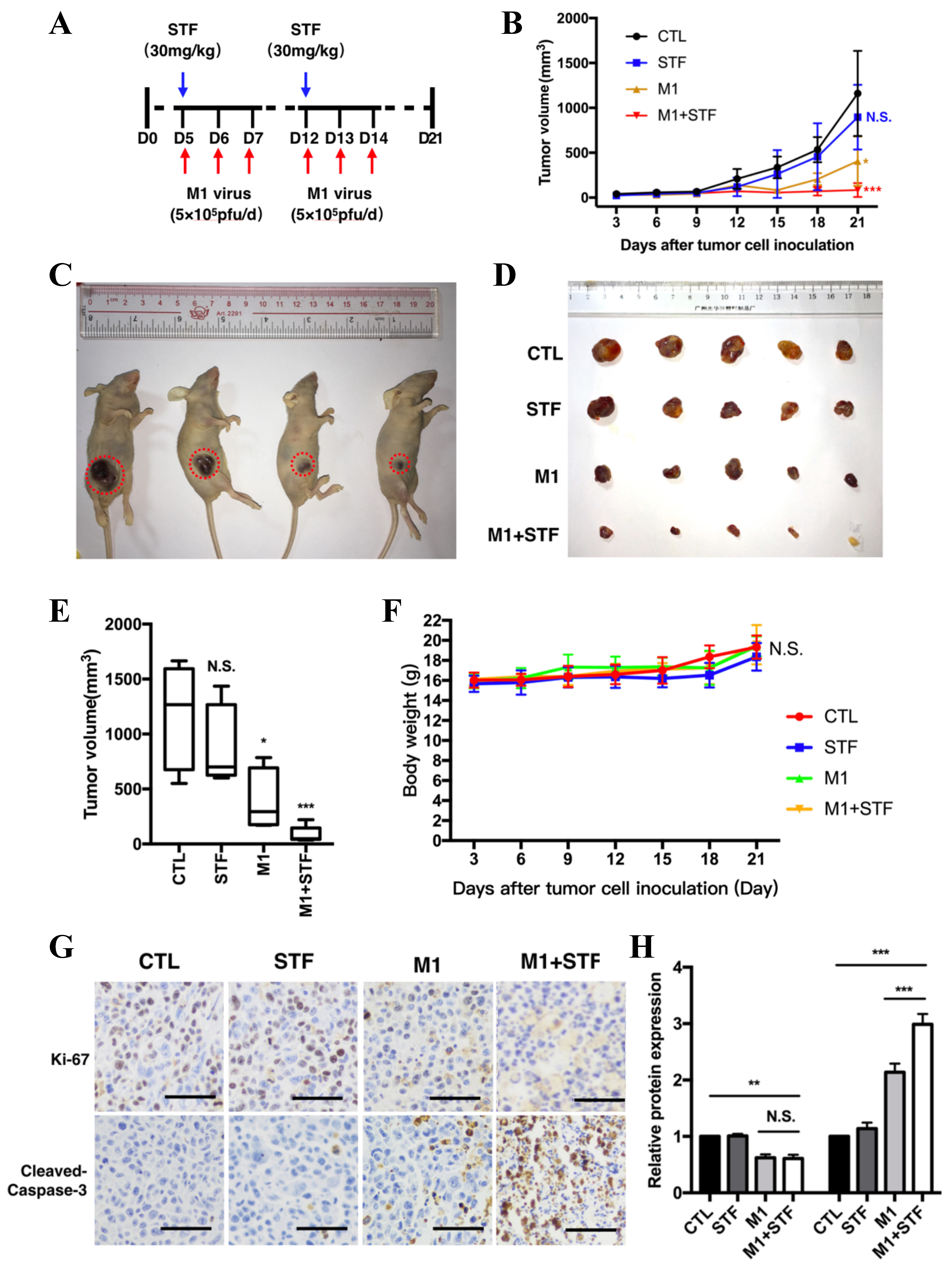 IRE1α modulates M1 oncolytic virus sensitivity via ER stress regulation in bladder cancer