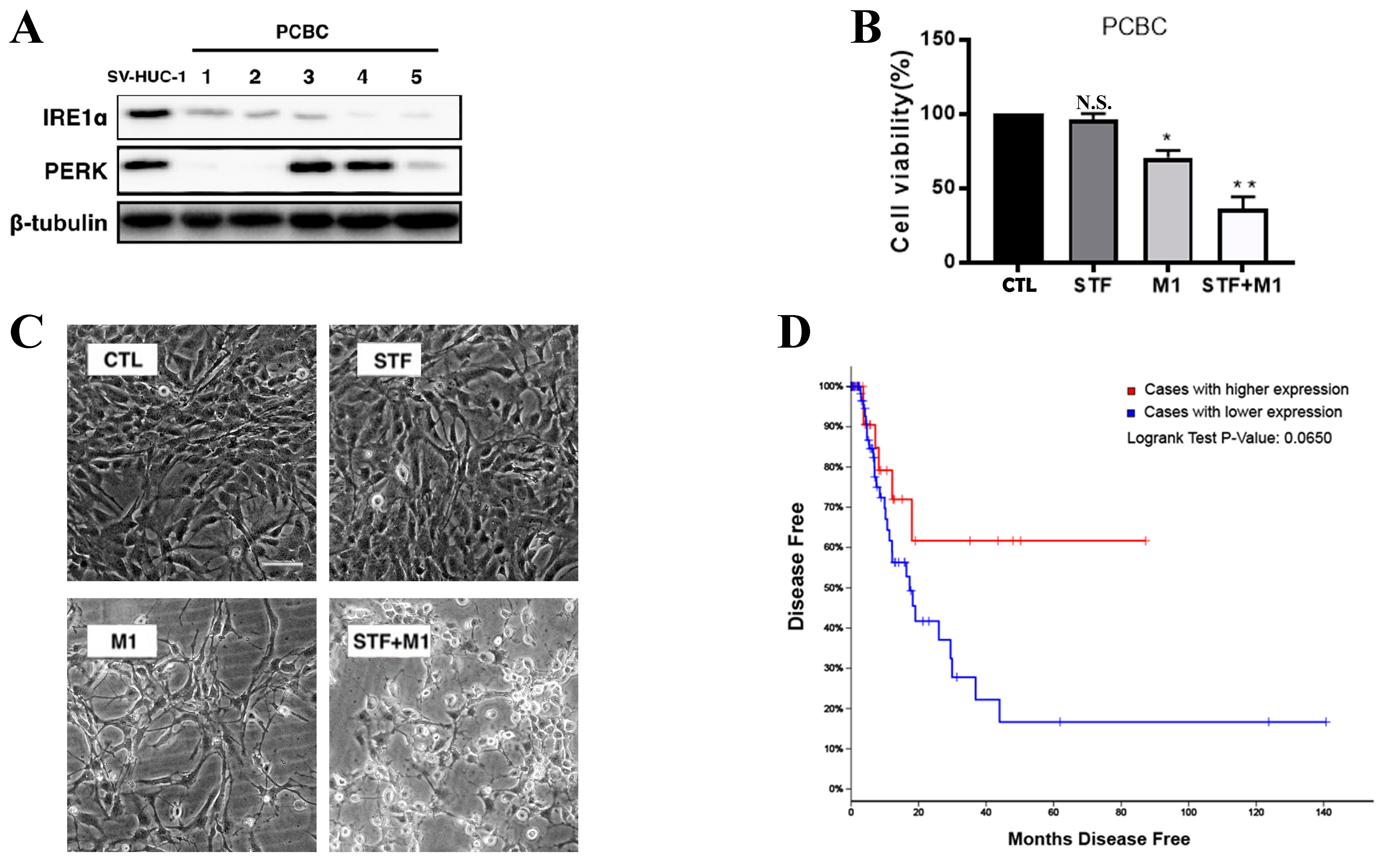 IRE1α modulates M1 oncolytic virus sensitivity via ER stress regulation in bladder cancer