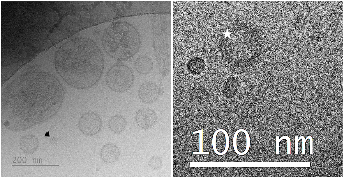 The extracellular vesicles of boar seminal plasma contain oxytocin at levels associated with fertility