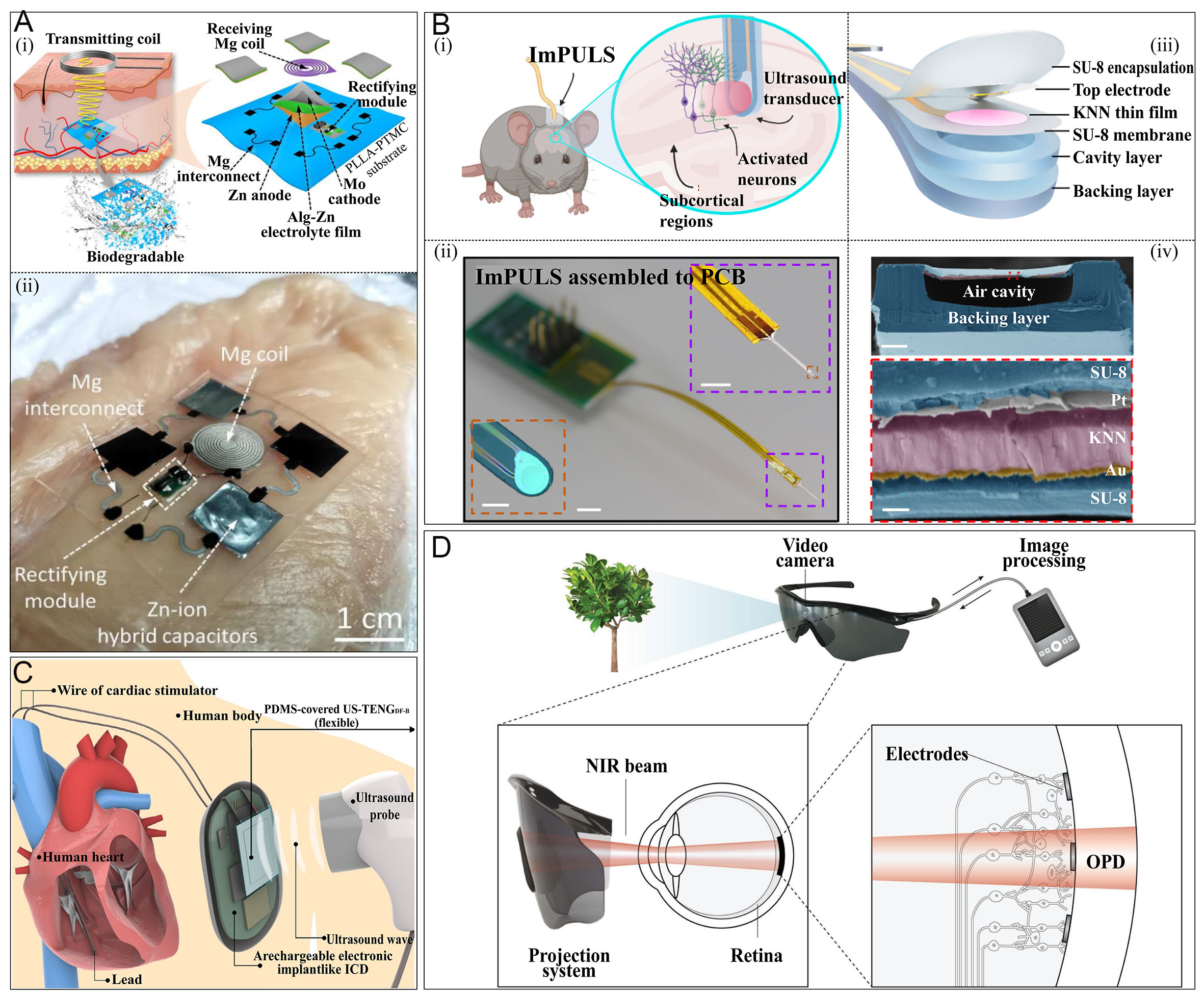 Sustainable clinical translation: development of implantable energy systems