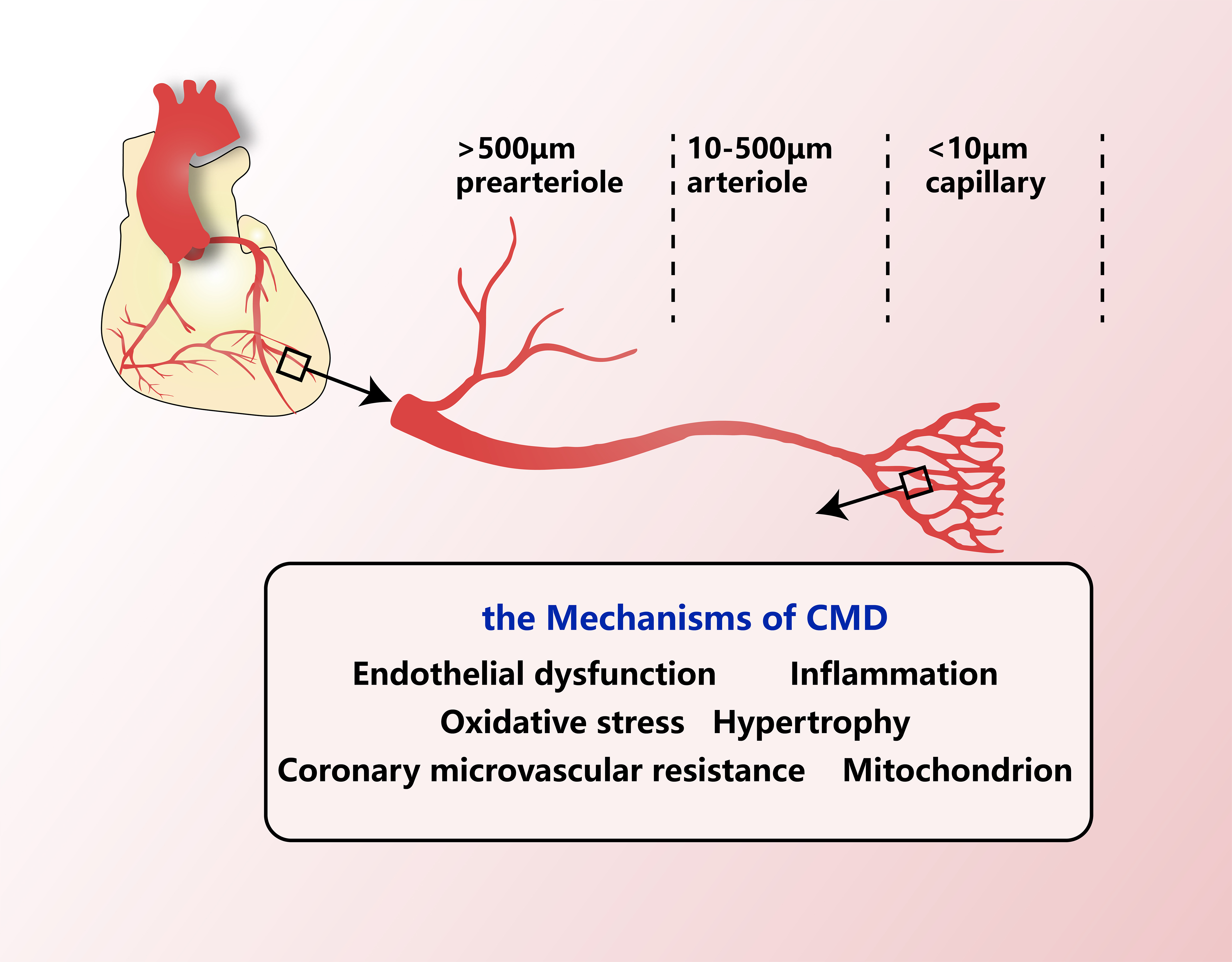 The emerging pathological mechanism of coronary microvascular dysfunction: a narrative review