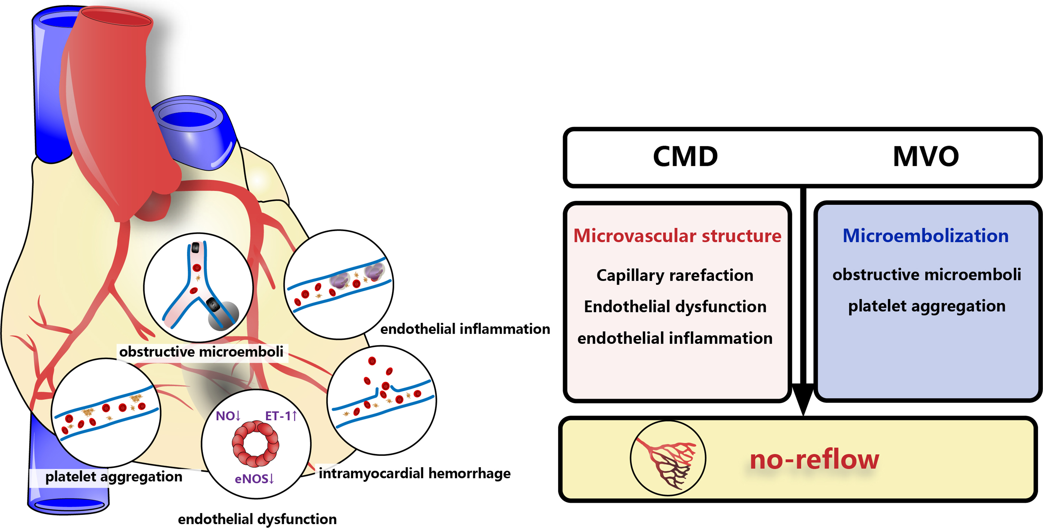 The emerging pathological mechanism of coronary microvascular dysfunction: a narrative review