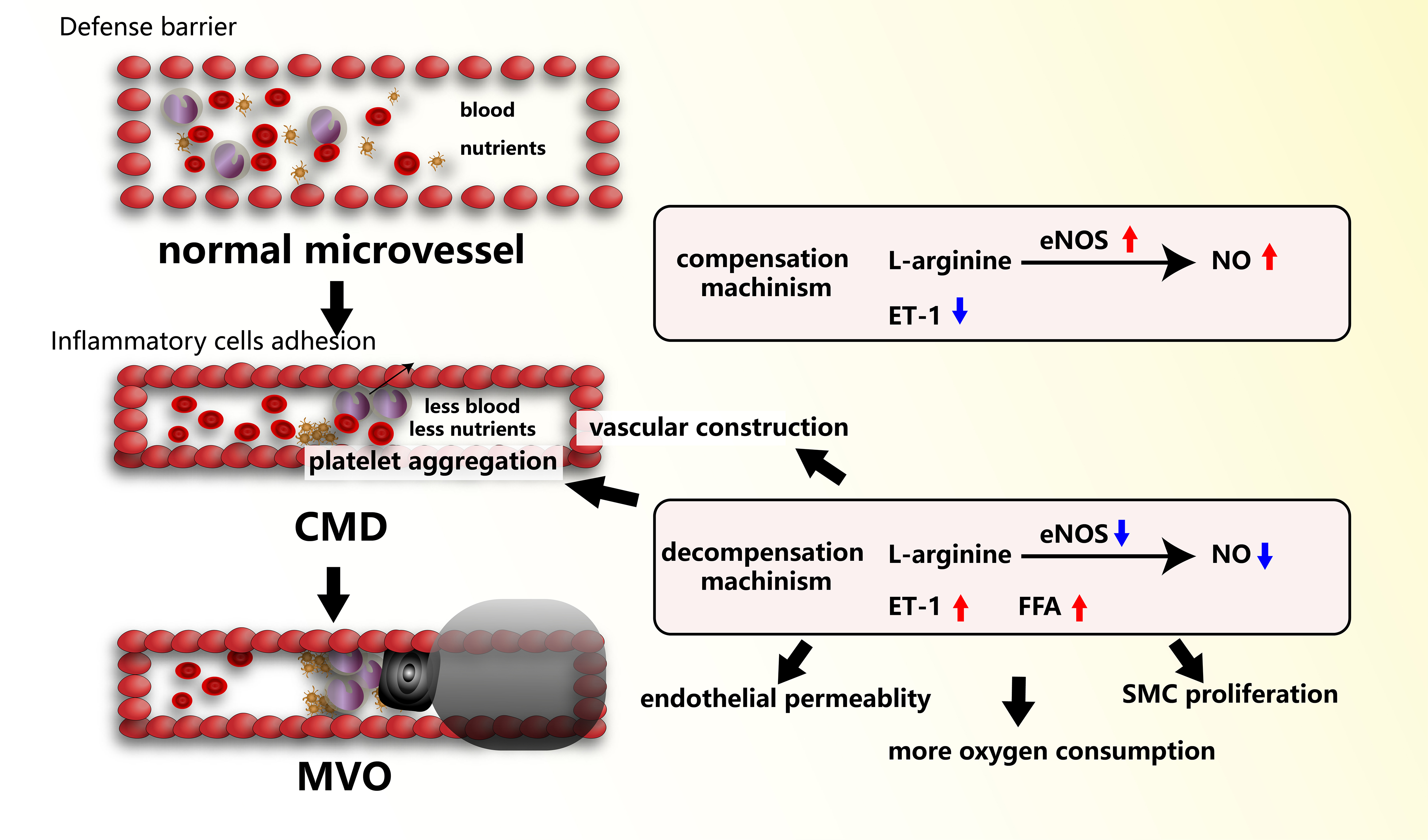 The emerging pathological mechanism of coronary microvascular dysfunction: a narrative review