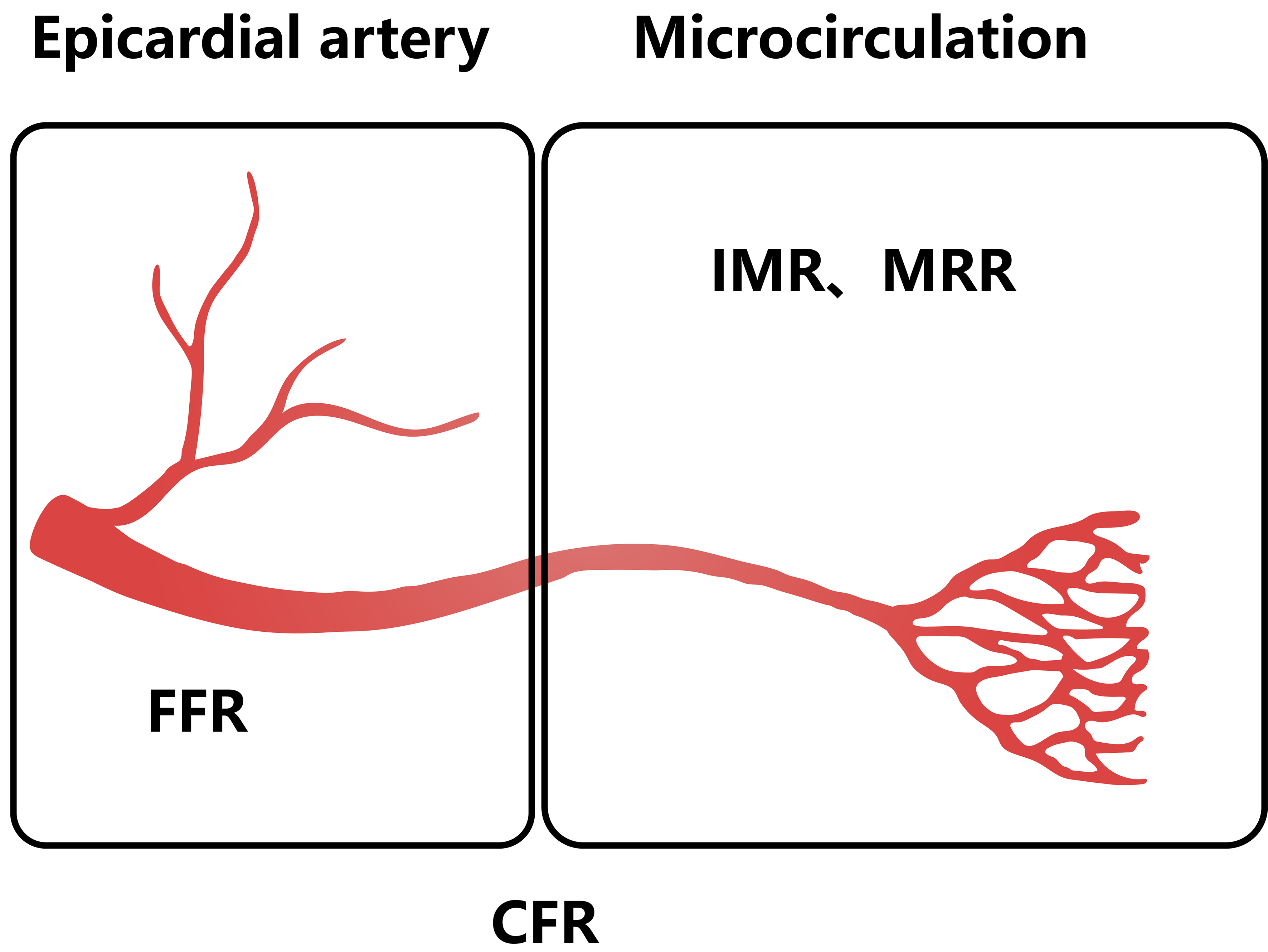 The emerging pathological mechanism of coronary microvascular dysfunction: a narrative review