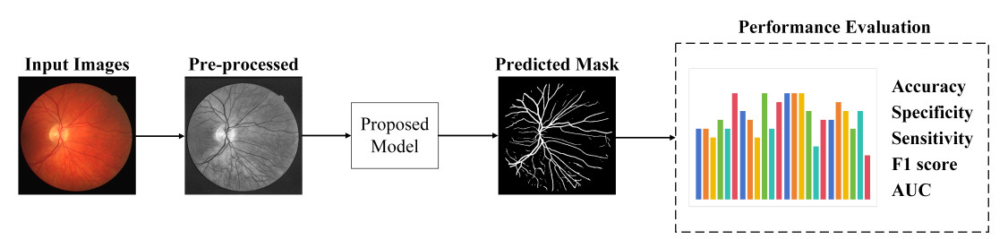An improved U-Net model with multiscale fusion for retinal vessel segmentation