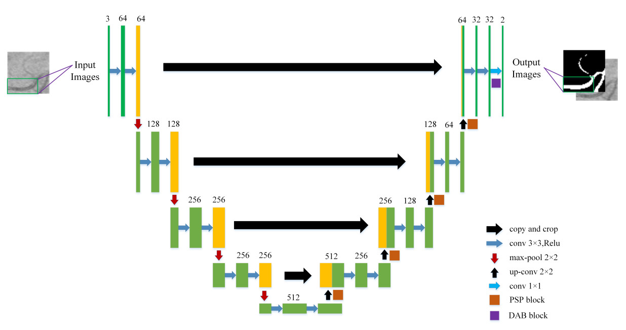 An improved U-Net model with multiscale fusion for retinal vessel segmentation