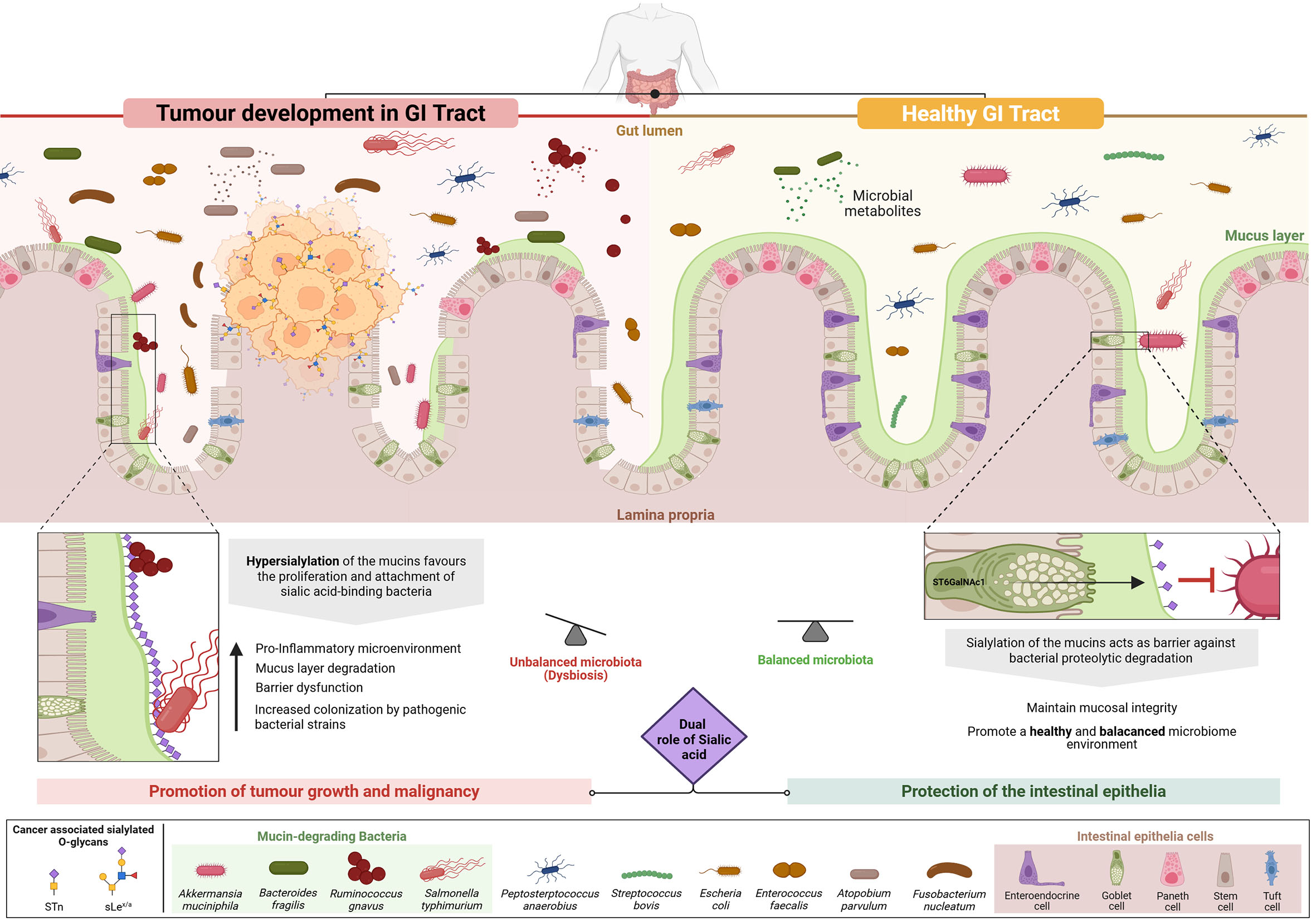 Cancer-associated O-glycans and microbiome interactions in colorectal cancer: insights into tumor progression and immune evasion