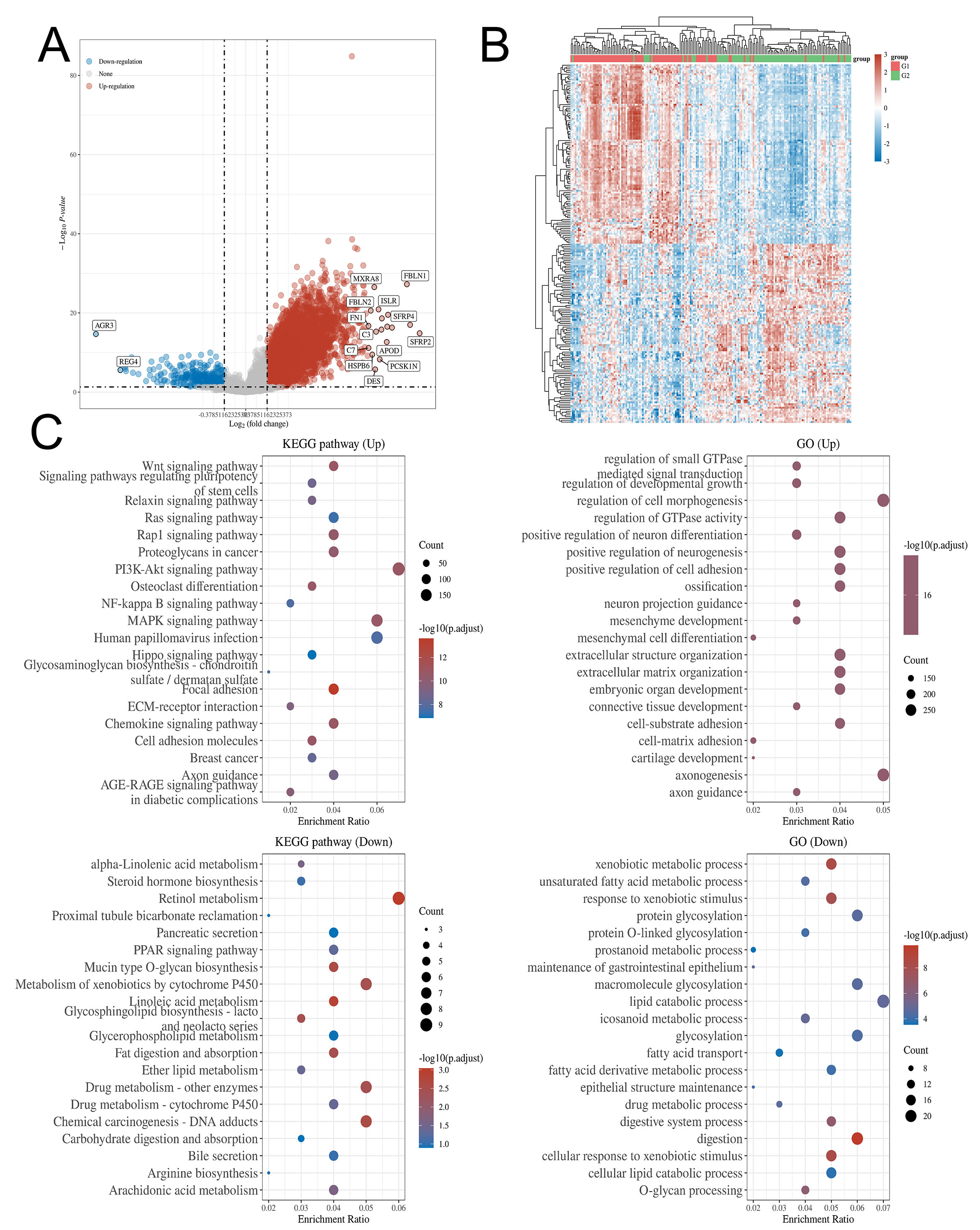 Deciphering the role of CHST14 in gastric cancer through <i>in silico</i> analysis