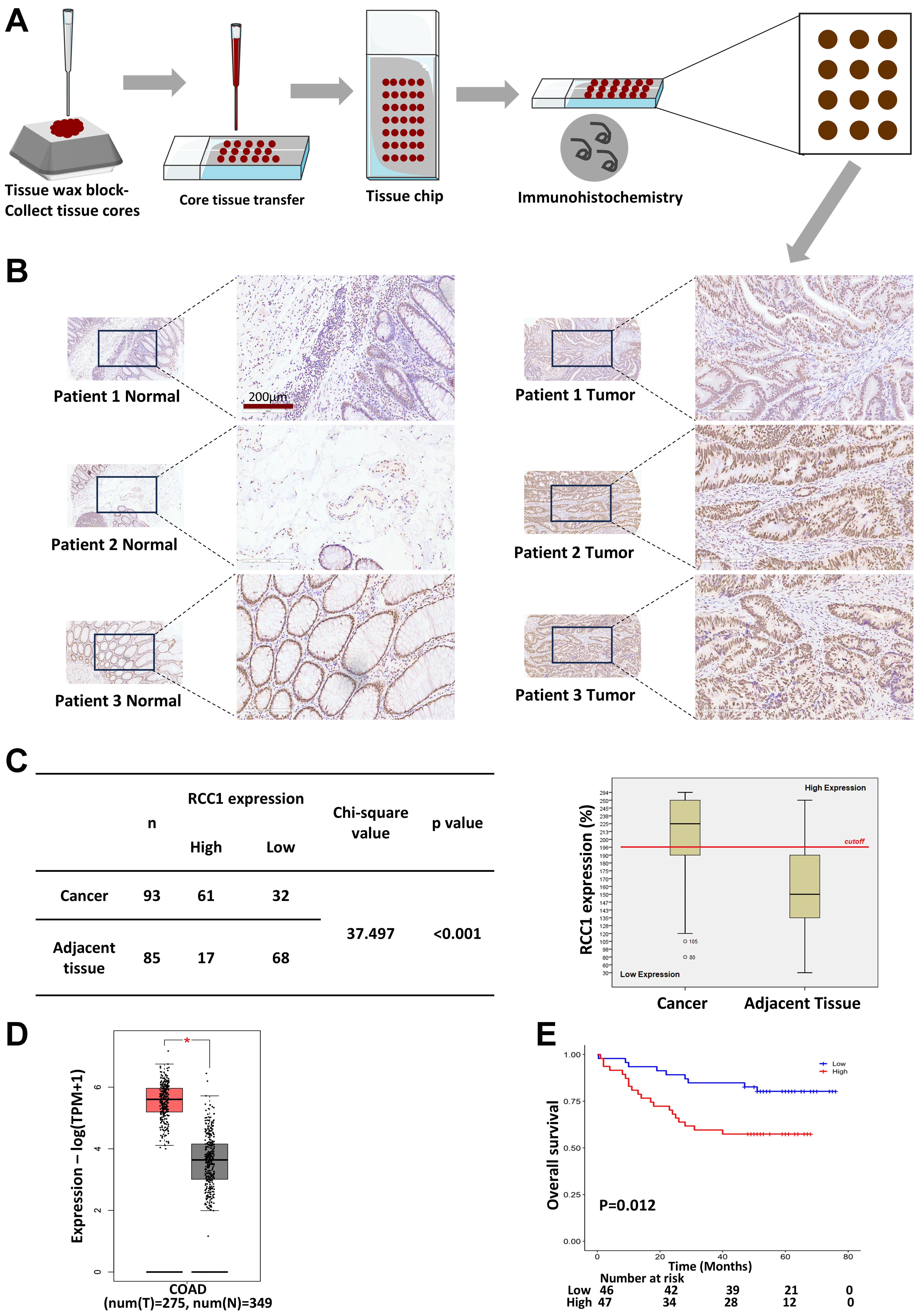 RCC1 knockdown sensitizes drug-resistant colorectal cancer to 5-fluorouracil or doxorubicin by impairing DNA repair
