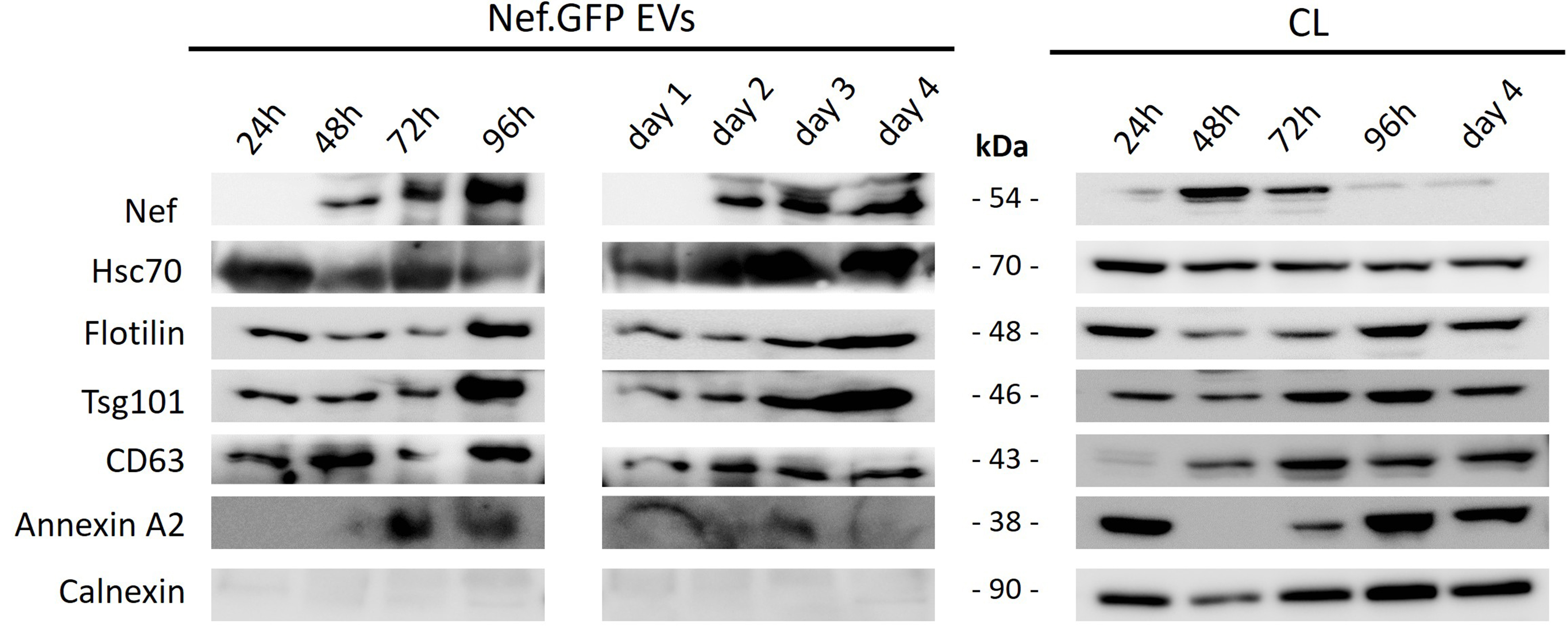 HIV protein Nef expression in human microglia drives the release of distinct Nef-containing extracellular vesicles